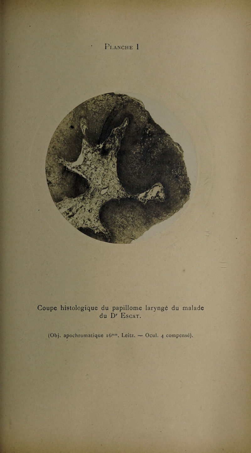 Planche 1 Coupe histologique du papillome laryngé du malade du Dr Escat. (Obj. apochromatique i6mm. Leitz. — Ocul. q compensé).