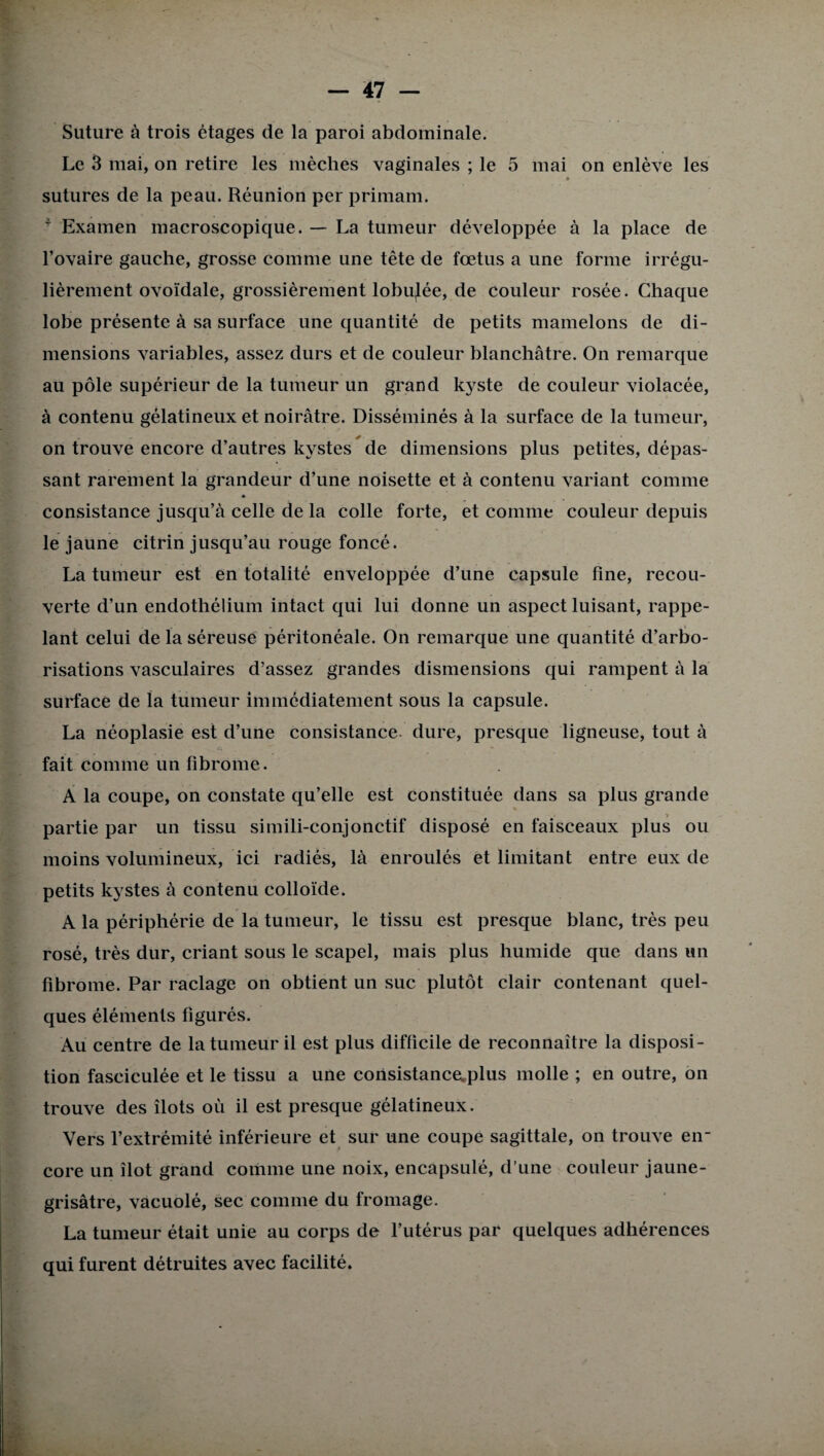 Suture à trois étages de la paroi abdominale. Le 3 mai, on retire les mèches vaginales ; le 5 mai on enlève les » sutures de la peau. Réunion per primam. ' Examen macroscopique. — La tumeur développée à la place de l’ovaire gauche, grosse comme une tête de fœtus a une forme irrégu¬ lièrement ovoïdale, grossièrement lobujée, de couleur rosée. Chaque lobe présente à sa surface une quantité de petits mamelons de di¬ mensions variables, assez durs et de couleur blanchâtre. On remarque au pôle supérieur de la tumeur un grand kyste de couleur violacée, à contenu gélatineux et noirâtre. Disséminés à la surface de la tumeur, + ■ on trouve encore d’autres kystes de dimensions plus petites, dépas¬ sant rarement la grandeur d’une noisette et à contenu variant comme * consistance jusqu’à celle de la colle forte, et comme couleur depuis le jaune citrin jusqu’au rouge foncé. La tumeur est en totalité enveloppée d’une capsule fine, recou¬ verte d’un endothélium intact qui lui donne un aspect luisant, rappe¬ lant celui de la séreuse péritonéale. On remarque une quantité d’arbo¬ risations vasculaires d’assez grandes dismensions qui rampent à la surface de la tumeur immédiatement sous la capsule. La néoplasie est d’une consistance dure, presque ligneuse, tout à •V». O * fait comme un fibrome. A la coupe, on constate qu’elle est constituée dans sa plus grande partie par un tissu simili-conjonctif disposé en faisceaux plus ou moins volumineux, ici radiés, là enroulés et limitant entre eux de petits kystes à contenu colloïde. A la périphérie de la tumeur, le tissu est presque blanc, très peu rosé, très dur, criant sous le scapel, mais plus humide que dans un fibrome. Par raclage on obtient un suc plutôt clair contenant quel¬ ques éléments figurés. Au centre de la tumeur il est plus difficile de reconnaître la disposi¬ tion fasciculée et le tissu a une consistance.plus molle ; en outre, on trouve des îlots où il est presque gélatineux. Vers l’extrémité inférieure et sur une coupe sagittale, on trouve en¬ core un îlot grand comme une noix, encapsulé, d’une couleur jaune- grisâtre, vacuolé, sec comme du fromage. La tumeur était unie au corps de l’utérus par quelques adhérences qui furent détruites avec facilité.