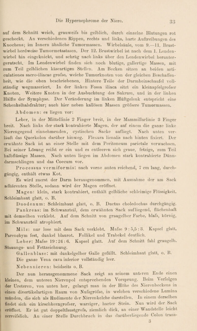 auf dem Schnitt weich, grauweifs bis gelblich, durch einzelne Blutungen rot gescheckt. An verschiedenen Kippen, rechts und links, harte Auftreibungen des Knochens; im Innern ähnliche Tumormassen. Wirbelsäule, vom 9.—11. Brust¬ wirbel herdweise Tumormetastasen. Der 12. Brustwirbel ist nach dem 1. Lenden¬ wirbel hin eingeknickt, und schräg nach links über den Lendenwirbel herunter¬ gerutscht. Im Lendenwirbel finden sich noch blutige, gallertige Massen, mit zum Teil gelblichen käseartigen Stellen. Am Becken sitzen an beiden arti- culationes sacro-iliacae grofse, weiche Tumorknoten von der gleichen Beschaffen¬ heit, wie die oben beschriebenen. Hintere Teile der Darmbeinschaufel voll¬ ständig wegmazeriert. In der linken Fossa iliaca sitzt ein kleinapfelgrofser Knoten. Weitere Knoten in der Ausbuchtung des Sakrum, und in der linken Hälfte der Symphyse. Der Veränderung im linken Hüftgelenk entspricht eine Schenkelhalsfraktur; auch hier neben kallösen Massen grölsere Tumormassen. Abdomen: es liegen vor: Leber, in der Mittellinie 2 Finger breit, in der Mammillarlinie 3 Finger breit. Nach links der stark kontrahierte Magen, der auf einem die ganze linke Nierengegend einnehmenden, cystischen Sacke aufliegt. Nach unten ver¬ läuft das Querkolon darüber hinweg. Flexura lienalis nach hinten fixiert. Der erwähnte Sack ist an einer Stelle mit dem Peritoneum parietale verwachsen. Bei seiner Lösung reifst er ein und es entleeren sich graue, fetzige, zum Teil halbflüssige Massen. Nach unten liegen im Abdomen stark kontrahierte Dünn¬ darmschlingen und das Coecum vor. Processus vermiformis: nach vorne unten reichend, 7 cm lang, durch¬ gängig, enthält etwas Kot. Es wird zuerst der Darm herausgenommen, mit Ausnahme der am Sack adhärenten Stelle, sodann wird der Magen eröffnet. Magen: klein, stark kontrahiert, enthält gelbliche schleimige Flüssigkeit. Schleimhaut glatt, o. B. Duodenum: Schleimhaut glatt, o. B. Ductus choledochus durchgängig. Pankreas: im Schwanzteil, dem erwähnten Sack auf liegend, flächenhaft mit demselben verklebt. Auf dem Schnitt von graugelber Farbe, blafs, körnig, im Schwanzteil atrophiert. Milz: nur lose mit dem Sack verklebt. Mafse 9 : 5,5 : 3. Kapsel glatt. Parenchym fest, dunkel blaurot. Follikel und Trabekel deutlich. Leber: Mafse 19:24:6. Kapsel glatt. Auf dem Schnitt fahl graugelb. Stauungs- und Fettzeichnung. Gallenblase: mit dunkelgelber Galle gefüllt. Schleimhaut glatt, o. B. Die ganze Vena cava inferior vollständig leer. Nebennieren: beidseits o. B. Der nun herausgenommene Sack zeigt an seinem unteren Ende einen kleinen, dem unteren Nierenpol entsprechenden Vorsprung. Beim Verfolgen der Ureteren, von unten her, gelangt man in der Höhe des Nierenbeckens in einen divertikelartigen Kaum von Nufsgröfse, in welchen verschiedene Lumina münden, die sich als Kudimente der Nierenkelche darstellen. In einem derselben findet sich ein kirschkerngrofser, warziger, harter Stein. Nun wird der Sack eröffnet. Er ist gut doppeltfaustgrofs, ziemlich dick, an einer Wandstelle leicht zerreifslich. An einer Stelle Durchbrach in das darüberliegende ( olon trans- 3