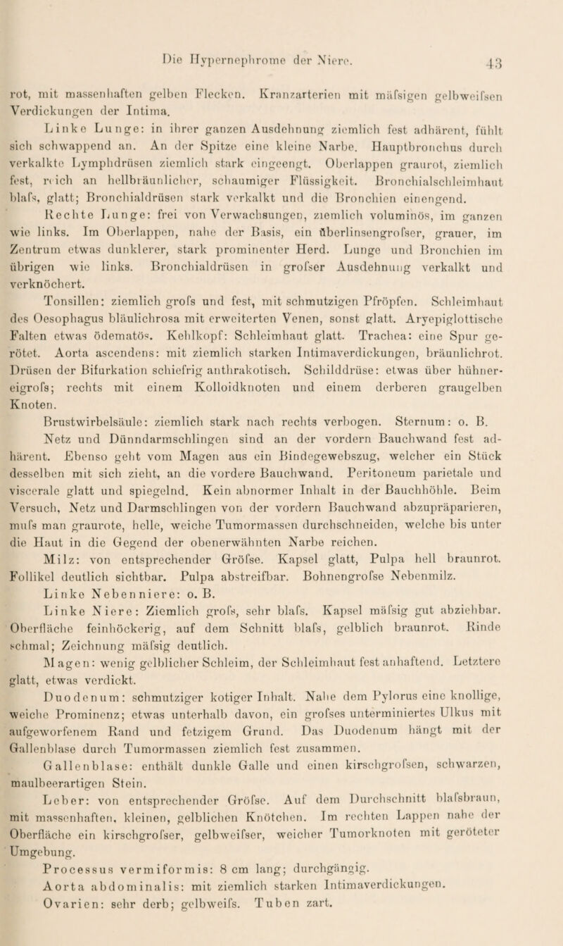 rot, mit massenhaften gelben Flecken. Kranzarterien mit mäfsigen gelbweifsen Verdickungen der Intima. Linke Lunge: in ihrer ganzen Ausdehnung ziemlich fest adhärent, fühlt sich schwappend an. An der Spitze eine kleine Narbe. Hauptbronchus durch verkalkte Lymphdrüsen ziemlich stark eingeengt. Oberlappen graurot, ziemlich fest, n ich an hellbiäunlicher, schaumiger Flüssigkeit. Bronchialschleimhaut blafs, glatt; Bronchialdrüsen stark verkalkt und die Bronchien oinengend. Rechte Lunge: frei von Verwachsungen, ziemlich voluminös, im ganzen wie links. Im Oberlappen, nahe der Basis, ein überlinsengrofser, grauer, im Zentrum etwas dunklerer, stark prominenter Herd. Lunge und Bronchien im übrigen wie links. Bronchialdrüsen in grofser Ausdehnung verkalkt und verknöchert. Tonsillen: ziemlich grofs und fest, mit schmutzigen Pfropfen. Schleimhaut des Oesophagus bläulichrosa mit erweiterten Venen, sonst glatt. Aryepiglottische Falten etwas ödematös. Kehlkopf: Schleimhaut glatt. Trachea: eine Spur ge¬ rötet. Aorta ascendens: mit ziemlich starken Intimaverdickungen, bräunlichrot. Drüsen der Bifurkation schiefrig anthrakotisch. Schilddrüse: etwas über hühner- eigrofs; rechts mit einem Kolloidknoten und einem derberen graugelben Knoten. Brustwirbelsäule: ziemlich stark nach rechts verbogen. Sternum: o. B. Netz und Dünndarmschlingen sind an der vordem Bauchwand fest ad¬ härent. Ebenso geht vom Magen aus ein Bindegewebszug, welcher ein Stück desselben mit sich zieht, an die vordere Bauchwand. Peritoneum parietale und viscerale glatt und spiegelnd. Kein abnormer Inhalt in der Bauchhöhle. Beim Versuch, Netz und Darmschlingen von der vordem Bauchwand abzupräparieren, mufs man graurote, helle, weiche Tumormassen durchschneiden, welche bis unter die Haut in die Gegend der obenerwähnten Narbe reichen. Milz: von entsprechender Gröfse. Kapsel glatt, Pulpa hell braunrot. Follikel deutlich sichtbar. Pulpa abstreifbar. Bohnengrofse Nebenmilz. Linke Nebenniere: o. B. Linke Niere: Ziemlich grofs, sehr blafs. Kapsel mäfsig gut abziehbar. Oberfläche feinhöckerig, auf dem Schnitt blafs, gelblich braunrot. Rinde schmal; Zeichnung mäfsig deutlich. Magen: wenig gelblicher Schleim, der Schleimhaut fest anhaftend. Letztere glatt, etwas verdickt. Duodenum: schmutziger kotiger Inhalt. Nahe dem Pylorus eine knollige, weiche Prominenz; etwas unterhalb davon, ein grofses unterminiertes Ulkus mit aufgeworfenem Rand und fetzigem Grund. Das Duodenum hängt mit der Gallenblase durch Tumormassen ziemlich fest zusammen. Gallenblase: enthält dunkle Galle und einen kirsebgrofsen, schwarzen, maulbeerartigen Stein. Leber: von entsprechender Gröfse. Auf dem Durchschnitt blalsbraun, mit massenhaften, kleinen, gelblichen Knötchen. Im rechten Lappen nahe der Oberfläche ein kirschgrofser, gelbweifser, weicher Tumorknoten mit geröteter Umgebung. Processus vermiformis: 8 cm lang; durchgängig. Aorta abdominalis: mit ziemlich starken Intimaverdickungen. Ovarien: sehr derb; gelbweifs. Tuben zart.