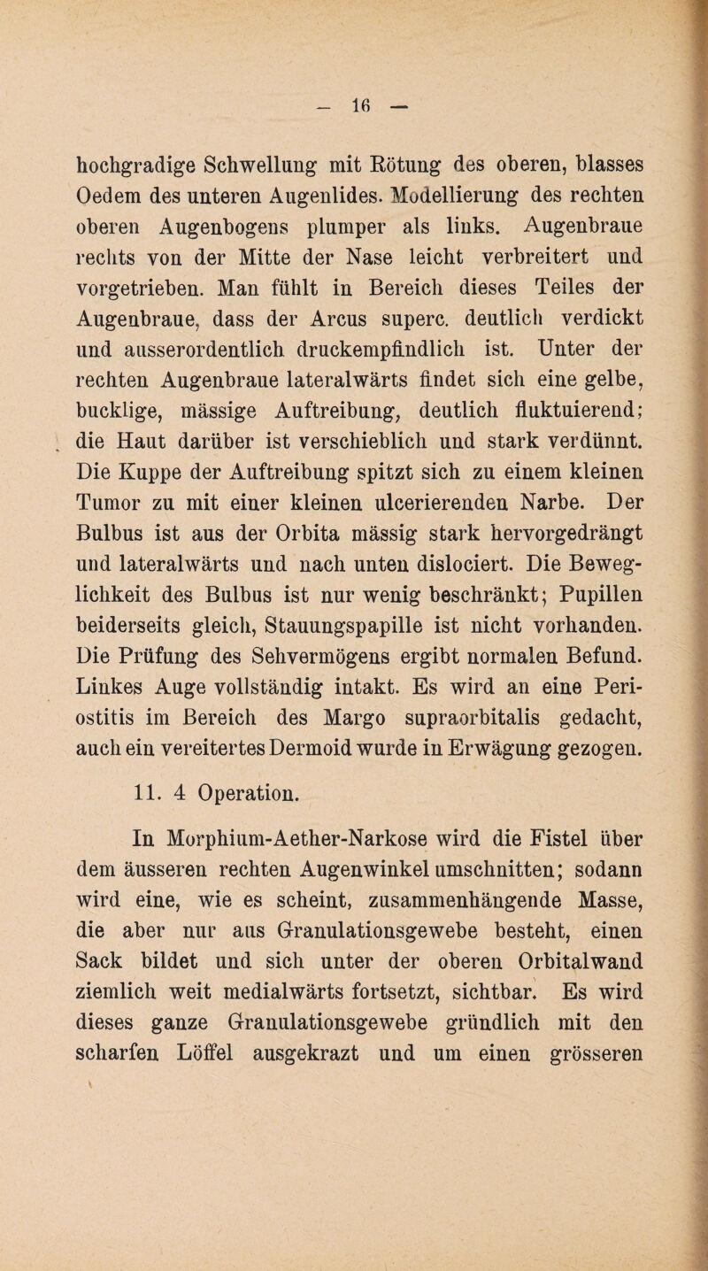hochgradige Schwellung mit Rötung des oberen, blasses Oedem des unteren Augenlides. Modellierung des rechten oberen Augenbogens plumper als links. Augenbraue rechts von der Mitte der Nase leicht verbreitert und vorgetrieben. Man fühlt in Bereich dieses Teiles der Augenbraue, dass der Arcus superc. deutlich verdickt und ausserordentlich druckempfindlich ist. Unter der rechten Augenbraue lateralwärts findet sich eine gelbe, bucklige, massige Auftreibung, deutlich fluktuierend; die Haut darüber ist verschieblich und stark verdünnt. Die Kuppe der Auftreibung spitzt sich zu einem kleinen Tumor zu mit einer kleinen ulcerierenden Narbe. Der Bulbus ist aus der Orbita massig stark hervorgedrängt und lateralwärts und nach unten dislociert. Die Beweg¬ lichkeit des Bulbus ist nur wenig beschränkt; Pupillen beiderseits gleich, Stauungspapille ist nicht vorhanden. Die Prüfung des Sehvermögens ergibt normalen Befund. Linkes Auge vollständig intakt. Es wird an eine Peri¬ ostitis im Bereich des Margo supraorbitalis gedacht, auch ein vereitertes Dermoid wurde in Erwägung gezogen. 11. 4 Operation. In Morphium-Aether-Narkose wird die Fistel über dem äusseren rechten Augenwinkel Umschnitten; sodann wird eine, wie es scheint, zusammenhängende Masse, die aber nur aus Granulationsgewebe besteht, einen Sack bildet und sich unter der oberen Orbitalwand ziemlich weit medialwärts fortsetzt, sichtbar. Es wird dieses ganze Granulationsgewebe gründlich mit den scharfen Löffel ausgekrazt und um einen grösseren