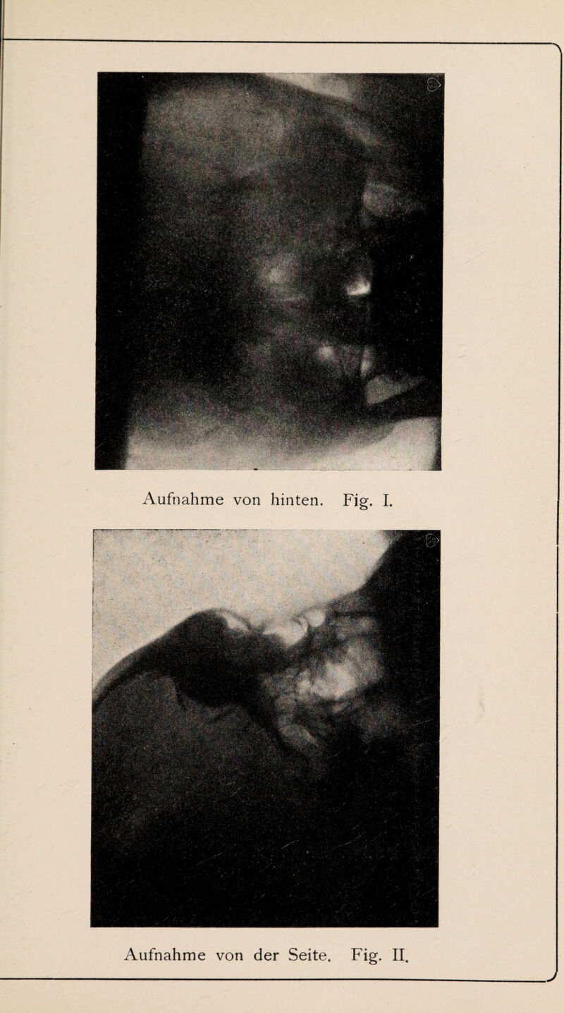 Aufnahme von der Seite. Fig. II J