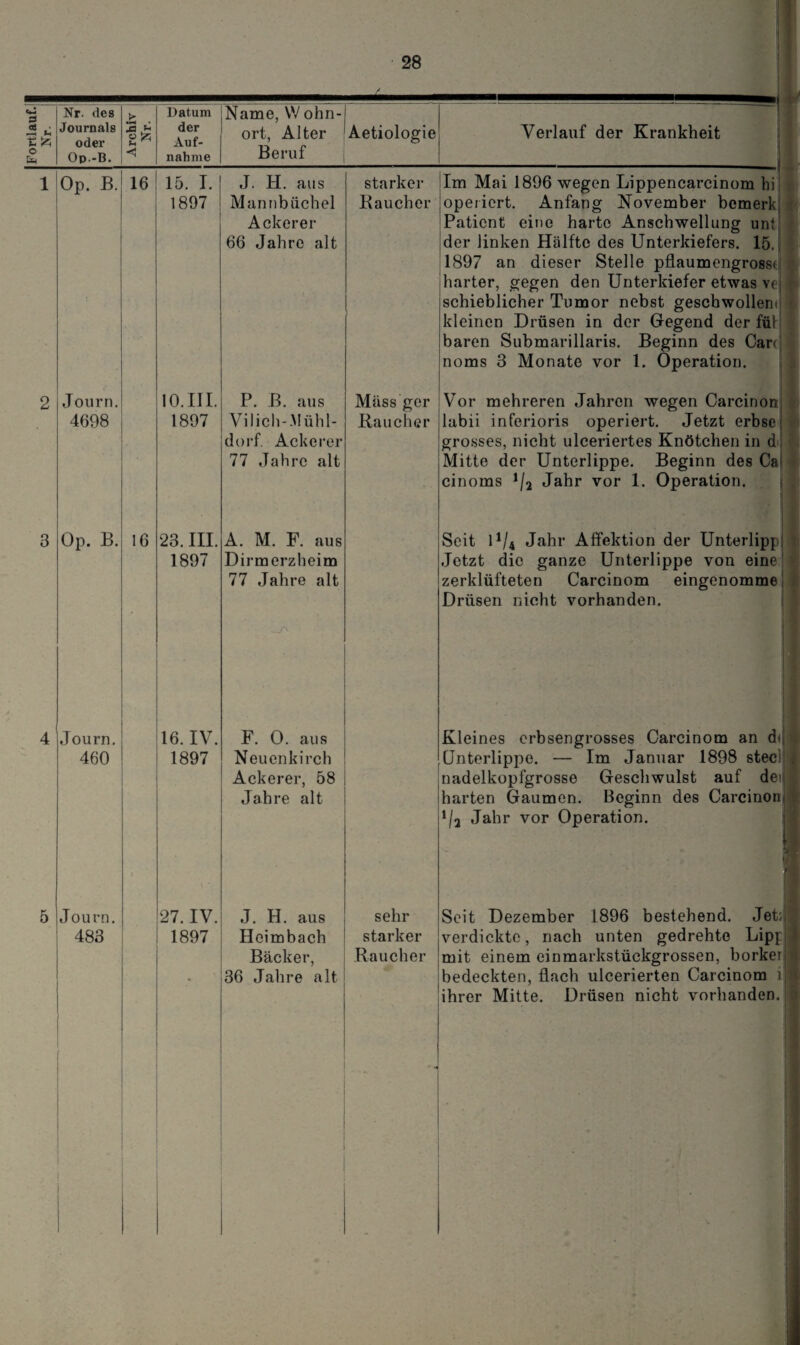 Nr. des > Datum Name, VVohn-l -- - - —--—[ <8 -• 1 *-< t; ^ Journals oder 'Ja u der Auf- ort, Alter Aetiologie Verlauf der Krankheit O Op.-B. < nähme Beruf 3 Op. B. Journ, 4698 16 Op. B. 16 Journ. 460 Journ. 483 15. I. 1897 J. H. aus Mannbüchel Ackerer 66 Jahre alt 10.III. 1897 23. III. 1897 16. IV. 1897 27. IV. 1897 P. B. aus VTi lieh-.Mühl¬ dorf. Ackerer 77 Jahre alt A. M. F. aus Dirmerzheim 77 Jahre alt F. 0. aus Neuenkirch Ackerer, 58 Jahre alt starker Kaucher J. H. aus Heimbach Bäcker, 36 Jahre alt sehr starker Raucher Mäss ger Raucher Im Mai 1896 wegen Lippencarcinom hi operiert. Anfang November bemerk Patient eine harte Anschwellung unt der linken Hälfte des Unterkiefers. 15. 1897 an dieser Stelle pflaumengrosst harter, gegen den Unterkiefer etwas vt schieblicher Tumor nebst geschwollentjl kleinen Drüsen in der Gegend der füll baren Submarillaris. Beginn des Care noms 3 Monate vor 1. Operation. Vor mehreren Jahren wegen Carcinon; labii inferioris operiert. Jetzt erbse grosses, nicht ulceriertes Knötchen in &J Mitte der Unterlippe. Beginn des Ca cinoms 1j2 Jahr vor 1. Operation. Seit D/4 Jahr Affektion der Unterlippi Jetzt die ganze Unterlippe von eine“ zerklüfteten Carcinom eingenomme Drüsen nicht vorhanden. Kleines erbsengrosses Carcinom an dt Unterlippe. — Im Januar 1898 stec1 j nadelkopfgrosse Geschwulst auf dei harten Gaumen. Beginn des Carcinon; s i/2 Jahr vor Operation. Seit Dezember 1896 bestehend. Jet:, verdickte, nach unten gedrehte Lipp j mit einemeinmarkstückgrossen, borker bedeckten, flach ulcerierten Carcinom ir ihrer Mitte. Drüsen nicht vorhanden.
