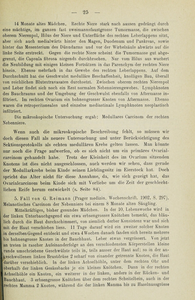 14 Monate altes Mädchen. Rechte Niere stark nach aussen gedrängt durch eine mächtige, im ganzen fast zweimannsfaustgrosse Tumormasse, die zwischen oberem Nierenpol, Hilus der Niere und Unterfläche des rechten Leberlappens sitzt, aber sich auch medialwärts hinter den Magen, Duodenum und Pankreas, sowie hinter das Mesenterium des Dünndarms und vor der Wirbelsäule abwärts auf die linke Seite erstreckt. Gegen die rechte Niere scheint die Tumormasse gut abge¬ grenzt, die Capsula fibrosa nirgends durchbrochen. Nur vom Hilus aus wuchert die Neubildung mit einigen kleinen Fortsätzen in das Parenchym der rechten Niere hinein. Ebenso mehrfach in das Gewebe des rechten Leberlappens. Auf dem Durchschnitt hat die Geschwulst medulläre Beschaffenheit, knolligen Bau, überall von reichlichen Blutextravasaten durchsetzt. Zwischen oberem rechten Nierenpol und Leber findet sich noch ein Rest normalen Nebennierengewebes. Lymphknoten des Bauchraums und der Umgebung der Geschwulst ebenfalls von Aftermasse in¬ filtriert. Im rechten Ovarium ein bohnengrosser Knoten von Aftermasse. Ebenso waren die retroperitonealen und einzelne mediastinale Lymphknoten neoplastisch infiltriert. Die mikroskopische Untersuchung ergab: Medulläres Carcinom der rechten Nebenniere. Wenn auch die mikroskopische Beschreibung fehlt, so müssen wir doch diesen Fall als neuere Untersuchung und unter Berücksichtigung des Sektionsprotokolls als echten medullären Krebs gelten lassen. Man könnte nur noch die Frage aufwerfen, ob es sich nicht um ein primäres Ovarial- carcinom gehandelt habe. Trotz der Kleinheit des im Ovarium sitzenden Knotens ist dies nicht ausgeschlossen, auch werden wir sehen, dass gerade der Medullarkrebs beim Kinde seinen Lieblingssitz im Eierstock hat. Doch spricht das Alter nicht für diese Annahme, da, wie sich gezeigt hat, das Övarialcarcinom beim Kinde sich mit Vorliebe um die Zeit der geschlecht¬ lichen Reife herum entwickelt (s. Seite 84). 5. Fall von G. R ei mann (Prager medizin. Wochenschrift. 1902. S. 297). Melanotisches Carcinom der Nebenniere bei einem 8 Monate alten Säugling. Mittelkräftiges, bisher gesundes Mädchen. In der 10. Lebenswoche wird in der linken Unterbauchgegend ein etwa erbsengrosses Knötchen bemerkt, das bläu¬ lich durch die Haut durchschimmert, von ziemlich derber Konsistenz war und sich I mit der Haut verschieben liess. 11 Tage darauf wird ein zweiter solcher Knoten I in derselben Gegend entdeckt und etwa 4 Wochen danach fanden sich bereits mehrere I bis bohnengrosse Knoten in der Bauchhaut. Leber etwas vergrössert. Von jetzt I an treten in rascher Aufeinanderfolge an den verschiedensten Körperstellen kleine I runde umschriebene Geschwülste teils in, teils ausser der Haut aut: so in der an- 1 geschwollenen linken Brustdrüse 2 scharf von einander getrennte Knoten, die Haut I darüber verschieblich, ln der linken Achselhöhle, unter dem rechten Ohr und II oberhalb der linken Gesässbacke je ein kleines Knötchen. Dann in der rechten 1 Achselhöhle ein Knoten, ein weiterer in der linken, andere in der Rücken- und 1 Bauchhaut. 3 erbsengrosse Knötchen über dem rechten Scheitelbein, auch in der iij rechten Mamma 2 Knoten, während die der linken Mamma bis zu Haselnussgrösse ;