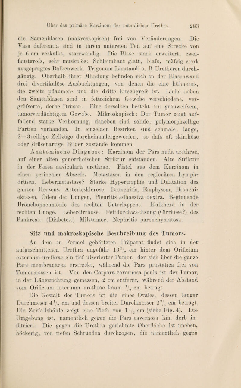 die Sameiiblasen (makroskopisch) frei von Veränderungen. Die Vasa deferentia sind in ihrem untersten Teil auf eine Strecke von je G cm verkalkt, starrwandig. Die Blase stark erweitert, zwei- faustgrofs, sehr muskulös; Schleimhaut glatt, hlafs, mäfsig stark ausgeprägtes Balkenwerk. Trigonum Lieutaudi o. B. Uretheren durch¬ gängig. Oberhalb ihrer Mündung befinden sich in der Blasenwand drei divertikulöse Ausbuchtungen, von denen die eine hühnerei-, die zweite pflaumen- und die dritte kirschgrofs ist. Links neben den Samenblasen sind in fettreichem Gewebe verschiedene, ver- gröfserte, derbe Drüsen. Eine derselben besteht aus grauweifsem, tumorverdächtigem Gewebe. Mikroskopisch: Der Tumor zeigt auf¬ fallend starke Verhornung, daneben sind solide, polymorphzellige Partien vorhanden. In einzelnen Bezirken sind schmale, lauge, 2 — 3reihige Zellzüge durcheinandergeworfen, so dafs oft skirrhöse oder drüsenartige Bilder zustande kommen. Anatomische Diagnose: Karzinom der Pars nuda urethrae, auf einer alten gonorrhoischen Striktur entstanden. Alte Striktur in der Possa navicularis urethrae. Distel aus dem Karzinom in einen perinealen Abszefs. Metastasen in den regionären Lymph- drüsen. Lebermetastase? Starke Hypertrophie und Dilatation des ganzen Herzens. Arteriosklerose. Bronchitis, Emphysem, Bronchi¬ ektasen, Ödem der Lungen, Pleuritis adhaesiva dextra. Beginnende Bronchopneumonie des rechten Unterlappens. Kalkherd in der rechten Lunge. Lebercirrhose. Fettdurchwachsung (Cirrhose?) des Pankreas. (Diabetes.) Milztumor. Nephritis parenchymatosa. Sitz und makroskopische Beschreib img des Tumors. An dem in Eormol gehärteten Präparat findet sich in der aufgeschnittenen Urethra ungefähr lö1/2 cm hinter dem Orificium externum urethrae ein tief ulzerierter Tumor, der sich über die ganze Pars membranacea erstreckt, während die Pars prostatica frei von Tumormassen ist. Von den Corpora cavernosa penis ist der Tumor, in der Längsrichtung gemessen, 2 cm entfernt, während der Abstand vom Orificium internum urethrae kaum 1/9 cm beträgt. Die Gestalt des Tumors ist die eines Ovales, dessen langer Durchmeser 4]/9 cm und dessen breiter Durchmesser 2:3/4 cm beträgt. Die Zerfallshöhle zeigt eine Tiefe von 11/2 cm (siehe Fig. 4). Die Umgebung ist, namentlich gegen die Pars cavernosa hin, derb in¬ filtriert. Die gegen die Urethra gerichtete Oberfläche ist uneben, höckerig, von tiefen Schrunden durchzogen, die namentlich gegen
