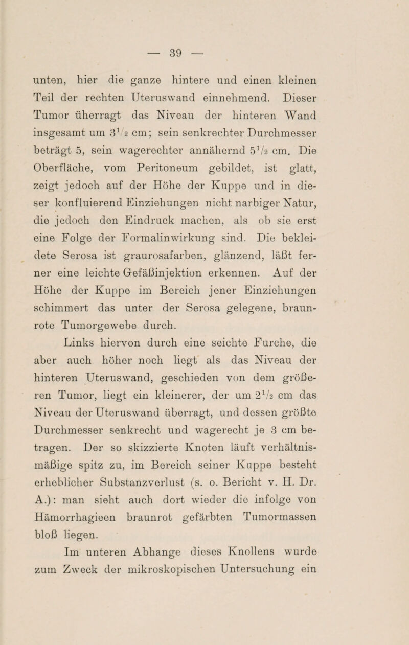 unten, hier die ganze hintere und einen kleinen Teil der rechten Uteruswand einnehmend. Dieser Tumor überragt das Niveau der hinteren Wand insgesamt um 31 2 cm; sein senkrechter Durchmesser beträgt 5, sein wagerechter annähernd 5V2 cm. Die Oberfläche, vom Peritoneum gebildet, ist glatt, zeigt jedoch auf der Höhe der Kuppe und in die¬ ser konfluierend Einziehungen nicht narbiger Natur, die jedoch den Eindruck machen, als ob sie erst eine Folge der Formalinwirkung sind. Die beklei¬ dete Serosa ist graurosafarben, glänzend, läßt fer¬ ner eine leichte Gefäßinjektion erkennen. Auf der Höhe der Kuppe im Bereich jener Einziehungen schimmert das unter der Serosa gelegene, braun¬ rote Tumorgewebe durch. Links hiervon durch eine seichte Furche, die aber auch höher noch liegt als das Niveau der hinteren Uteruswand, geschieden von dem größe¬ ren Tumor, liegt ein kleinerer, der um 2V2 cm das Niveau der Uteruswand überragt, und dessen größte Durchmesser senkrecht und wagerecht je 3 cm be¬ tragen. Der so skizzierte Knoten läuft verhältnis¬ mäßige spitz zu, im Bereich seiner Kuppe besteht erheblicher Substanzverlust (s. 0. Bericht v. H. Dr. A.): man sieht auch dort wieder die infolge von Hämorrhagieen braunrot gefärbten Tumormassen bloß liegen. Im unteren Abhange dieses Knollens wurde zum Zweck der mikroskopischen Untersuchung ein