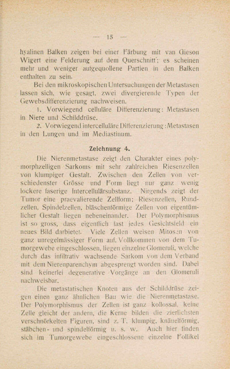 hyalinen Balken zeigen bei einer Färbung mit van (lieson Wigert eine Felderung auf dem Querschnitt; es scheinen mehr und weniger aufgequollene Partien in den Balken enthalten zu sein. Bei den mikroskopischen Untersuchungen der Metastasen lassen sich, wie gesagt, zwei divergierende Typen der (iewebsdifferenzierung nach weisen. 1. Vorwiegend cellulare Differenzierung: Metastasen in Niere und Schilddrüse. 2. Vorwiegend intercelluläre Differenzierung: Metastasen in den Lungen und im Mediastinum. Zeichnung- 4. Die Nierenmetastase zeigt den Charakter eines poly¬ morphzelligen Sarkoms mit sehr zahlreichen Riesenzellen von klumpiger Gestalt. Zwischen den Zellen von ver¬ schiedenster Grösse und Form liegt nur ganz wenig- lockere faserige Intercellulärsubstanz. Nirgends zeigt der Tumor eine praevalierende Zellform; Riesenzellen, Rund¬ zellen, Spindelzellen, bläschenförmige Zellen von eigentüm¬ licher Gestalt liegen nebeneinander. Der Polymorphismus ist so gross, dass eigentlich fast jedes Gesichtsfeld ein neues Bild darbietet. Viele Zellen weisen Mitosen von ganz unregelmässiger Form auf. Vollkommen von dem Tu¬ morgewebe eingeschlossen, liegen einzelne Glomeruli, welche durch das infiltrativ wachsende- Sarkom von dem Verband mit dem Nierenparenchym abgesprengt worden sind. Dabei sind keinerlei degenerative Vorgänge an den Glomeruli nachweisbar. Die metastatischen Knoten aus der Schilddrüse zei¬ gen einen ganz ähnlichen Bau wie die Nierenmetastase. Der Polymorphismus der Zellen ist ganz kollossal, keine Zelle gleicht der andern, die Kerne bilden die zierlichsten verschnörkelten Figuren, sind z. T. klumpig, knäuelförmig, Stäbchen- und spindelförmig u. s. w. Auch hier finden sich im Tumorgewebe eingeschlossene einzelne Follikel