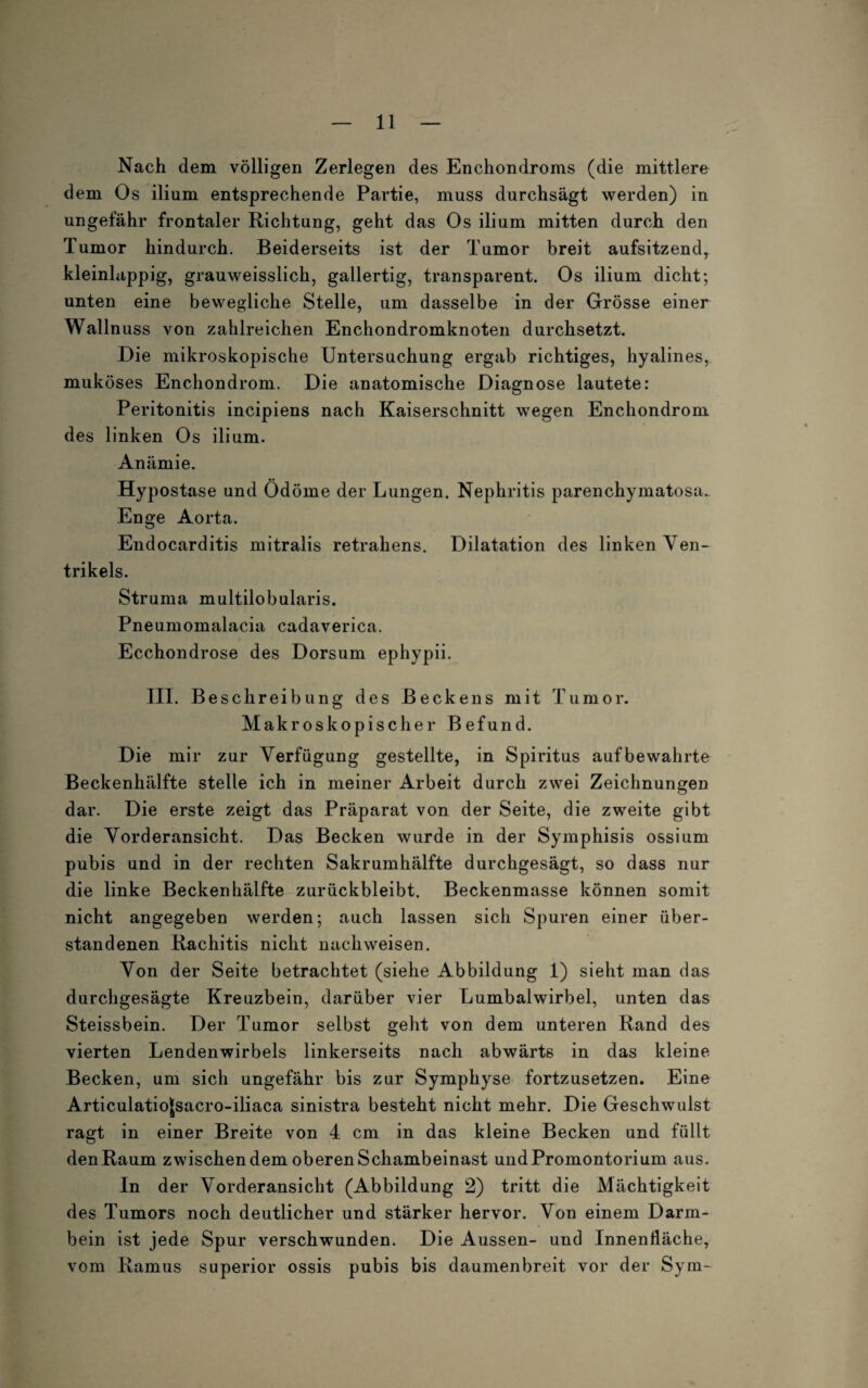 Nach dem völligen Zerlegen des Enchondroms (die mittlere dem Os ilium entsprechende Partie, muss durchsägt werden) in ungefähr frontaler Richtung, geht das Os ilium mitten durch den Tumor hindurch. Beiderseits ist der Tumor breit aufsitzend, kleinlappig, grauweisslich, gallertig, transparent. Os ilium dicht; unten eine bewegliche Stelle, um dasselbe in der Grösse einer Wallnuss von zahlreichen Enchondromknoten durchsetzt. Die mikroskopische Untersuchung ergab richtiges, hyalines, muköses Enchondrom. Die anatomische Diagnose lautete: Peritonitis incipiens nach Kaiserschnitt wegen Enchondrom des linken Os ilium. Anämie. Hypostase und Ödöme der Lungen. Nephritis parenchymatosa. Enge Aorta. Endocarditis mitralis retrahens. Dilatation des linken Ven¬ trikels. Struma multilobularis. Pneumomalacia cadaverica. Ecchondrose des Dorsum ephypii. III. Beschreibung des Beckens mit Tumor. Makroskopischer Befund. Die mir zur Verfügung gestellte, in Spiritus aufbewahrte Beckenhälfte stelle ich in meiner Arbeit durch zwei Zeichnungen dar. Die erste zeigt das Präparat von der Seite, die zweite gibt die Vorderansicht. Das Becken wurde in der Symphisis ossium pubis und in der rechten Sakrumhälfte durchgesägt, so dass nur die linke Beckenhälfte zurückbleibt. Beckenmasse können somit nicht angegeben werden; auch lassen sich Spuren einer über¬ standenen Rachitis nicht nachweisen. Von der Seite betrachtet (siehe Abbildung 1) sieht man das durchgesägte Kreuzbein, darüber vier Lumbalwirbel, unten das Steissbein. Der Tumor selbst geht von dem unteren Rand des vierten Lendenwirbels linkerseits nach abwärts in das kleine Becken, um sich ungefähr bis zur Symphyse fortzusetzen. Eine Articulatiojsacro-iliaca sinistra besteht nicht mehr. Die Geschwulst ragt in einer Breite von 4 cm in das kleine Becken und füllt den Raum zwischen dem oberen Schambeinast und Promontorium aus. In der Vorderansicht (Abbildung 2) tritt die Mächtigkeit des Tumors noch deutlicher und stärker hervor. Von einem Darm¬ bein ist jede Spur verschwunden. Die Aussen- und Innenfläche, vom Ramus superior ossis pubis bis daumenbreit vor der Sym-