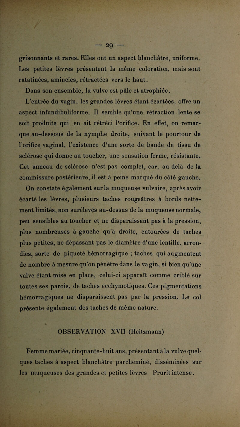 grisonnants et rares. Elles ont un aspect blanchâtre, uniforme. Les petites lèvres présentent la même coloration, mais sont ratatinées, amincies, rétractées vers le haut. Dans son ensemble, la vulve est pâle et atrophiée. . L’entrée du vagin, les grandes lèvres étant écartées, offre un aspect infundibuliforme. Il semble qu’une rétraction lente se soit produite qui en ait rétréci l’orifice. En effet, on remar¬ que au-dessous de la nymphe droite, suivant le pourtour de l’orifice vaginal, l’existence d’une sorte de bande de tissu de sclérose qui donne au toucher, une sensation ferme, résistante. Cet anneau de sclérose n’est pas complet, car, au delà de la commissure postérieure, il est à peine marqué du côté gauche. On constate également sur la muqueuse vulvaire, après avoir écarté les lèvres, plusieurs taches rougeâtres à bords nette¬ ment limités, non surélevés au-dessus de la muqueuse normale, peu sensibles au toucher et ne disparaissant pas à la pression, plus nombreuses à gauche qu’à droite, entourées de taches plus petites, ne dépassant pas le diamètre d’une lentille, arron¬ dies, sorte de piqueté hémorragique ; taches qui augmentent de nombre à mesure qu’on pénètre dans le vagin, si bien qu'une valve étant mise en place, celui-ci apparaît comme criblé sur toutes ses parois, de taches ecchymotiques. Ces pigmentations hémorragiques ne disparaissent pas par la pression. Le col présente également des taches de même nature. OBSERVATION XVII (Heitzmann) * i Femme mariée, cinquante-huit ans, présentant à la vulve quel¬ ques taches à aspect blanchâtre parcheminé, disséminées sur les muqueuses des grandes et petites lèvres. Prurit intense.