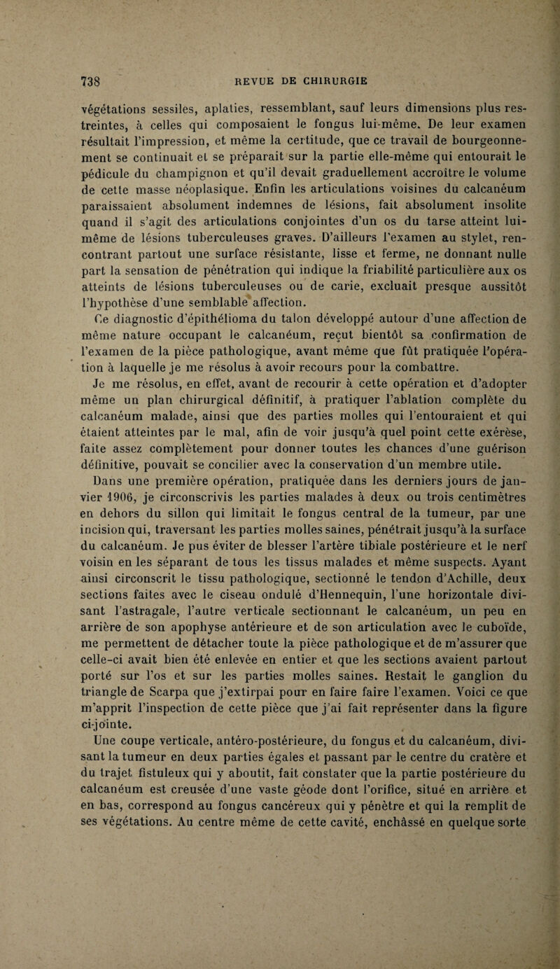 végétations sessiles, aplaties, ressemblant, sauf leurs dimensions plus res¬ treintes, à celles qui composaient le fongus lui-même. De leur examen résultait l’impression, et même la certitude, que ce travail de bourgeonne¬ ment se continuait et se préparait sur la partie elle-même qui entourait le pédicule du champignon et qu’il devait graduellement accroître le volume de cette masse néoplasique. Enfin les articulations voisines du calcanéum paraissaient absolument indemnes de lésions, fait absolument insolite quand il s’agit des articulations conjointes d’un os du tarse atteint lui- même de lésions tuberculeuses graves. D’ailleurs l’examen au stylet, ren¬ contrant partout une surface résistante, lisse et ferme, ne donnant nulle part la sensation de pénétration qui indique la friabilité particulière aux os atteints de lésions tuberculeuses ou de carie, excluait presque aussitôt l’hypothèse d’une semblable affection. Ce diagnostic d’épithélioma du talon développé autour d’une affection de même nature occupant le calcanéum, reçut bientôt sa confirmation de l’examen de la pièce pathologique, avant même que fût pratiquée l’opéra¬ tion à laquelle je me résolus à avoir recours pour la combattre. Je me résolus, en effet, avant de recourir à cette opération et d’adopter même un plan chirurgical définitif, à pratiquer l’ablation complète du calcanéum malade, ainsi que des parties molles qui l’entouraient et qui étaient atteintes par le mal, afin de voir jusqu’à quel point cette exérèse, faite assez complètement pour donner toutes les chances d’une guérison définitive, pouvait se concilier avec la conservation d’un membre utile. Dans une première opération, pratiquée dans les derniers jours de jan¬ vier 4906, je circonscrivis les parties malades à deux ou trois centimètres en dehors du sillon qui limitait le fongus central de la tumeur, par une incision qui, traversant les parties molles saines, pénétrait jusqu’à la surface du calcanéum. Je pus éviter de blesser l’artère tibiale postérieure et le nerf voisin en les séparant de tous les tissus malades et même suspects. Ayant ainsi circonscrit le tissu pathologique, sectionné le tendon d’Achille, deux sections faites avec le ciseau ondulé d’Hennequin, l’une horizontale divi¬ sant l’astragale, l’autre verticale sectionnant le calcanéum, un peu en arrière de son apophyse antérieure et de son articulation avec le cuboïde, me permettent de détacher toute la pièce pathologique et de m’assurer que celle-ci avait bien été enlevée en entier et que les sections avaient partout porté sur l’os et sur les parties molles saines. Restait le ganglion du triangle de Scarpa que j’extirpai pour en faire faire l’examen. Voici ce que m’apprit l’inspection de cette pièce que j’ai fait représenter dans la figure ci-jointe. Une coupe verticale, antéro-postérieure, du fongus et du calcanéum, divi¬ sant la tumeur en deux parties égales et passant par le centre du cratère et du trajet fistuleux qui y aboutit, fait constater que la partie postérieure du calcanéum est creusée d’une vaste géode dont l’orifice, situé en arrière et en bas, correspond au fongus cancéreux qui y pénètre et qui la remplit de ses végétations. Au centre même de cette cavité, enchâssé en quelque sorte