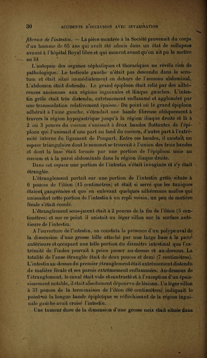 fibreux de [‘intestin. — La pièce montrée à la Société provenait du corps d’un homme de 65 ans qui avait été admis dans un état de collapsus avancé à l’hôpital Royal libre et qui mourut avant qu’on ait pu le mettre au lit L’autopsiç des organes céphaliques et thoraciques ne révéla riein de pathologique. Le testicule gauche n’était pas descendu dans le scro¬ tum et était situé immédiatement en dehors de l'anneau, abdominal. * , . L’abdomen était distendu. Le grand épiploon était relié par des adhé¬ rences anciennes aux régions inguinales et iliaque gauches. L’intes¬ tin grêle était très distendu, extrêmement enflammé et aggloméré par une transsudation relativement épaisse. Du point où le grand épiploon adhérait à l’aine gauche, s’étendait,une bande fibreuse obliquement à travers la région hypogastrique jusqu’à la région iliaque droite et là à 2 ou 3 pouces du cæcum s’unissait à deux bandes flottantes de l’épi¬ ploon qui Punissait d’une part au fond du cæcum, d’autre part à l’extré¬ mité interne du ligament de Poupart. Entre ces bandes, il existait un espace triangulaire dont le sommet se trouvait à l’union des trois bandes et dont la baserait formée par une portion de l’épiploon unie au cæcum et à la paroi abdominale dans la région iliaque droite. Dans cet espace une portion de l’intestin s’était-invaginée et s’y était étranglée. L’étranglement portait sur une portion de l’intestin grêle, située à 6 pouces de l’iléon (15 centimètres) et était si serré que les tuniques étaient gangrénées et que* en enlevant quelques adhérences molles qui unissaient cette portion de l’intestin à un repli voisin, un peu de matière fécale s’était écoulé. L’étranglement sous-jacent était à 2 pouces de la fin de l’iléon (5 cen¬ timètres) et sur ce point il existait un léger sillon sur la surface anté¬ rieure de l’intestin. A l’ouverture de l’intestin, on constata la présence d’un polype oval de la dimension d’une grosse bille attaché par une large base à la paro1 antérieure et occupant une telle portion du diamètre intestinal quç l’ex¬ trémité de l’index pouvait à peine passer au-dessus et au-dessous. La totalité de l’anse étranglée était de deux pouces et demi (7 centimètres). L’intestin au-dessus du premier étranglement était extrêmement distendu de matière fécale et ses parois extrêmement enflammées. Au-dessous de L’étranglement, le canal était vide et contracté et à l’exception d’un épais¬ sissement notable, il était absolument dépourvu de lésions. Un léger sillon à 33 pouces de la terminaison de l’iléon (80 centimètres) indiquait le point-où la longue bande épiploïque se réfléchissant de la région ingui¬ nale gauche avait croisé l’intestin. Une tumeur dure de la dimension d’une grosse noix était située dans