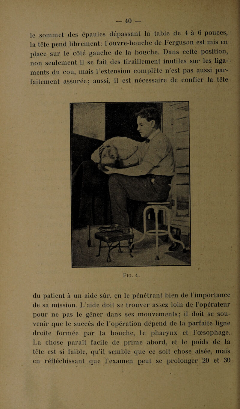 le sommet des épaules dépassant la table de 1 à b pouces, la tête pend librement: rouvre-bouche de Ferguson est mis en place sur le côté gauche de la bouche. Dans cette position, non seulement il se fait des tiraillement inutiles sur les liga¬ ments du cou, mais l’extension complète n’est pas aussi par¬ faitement assurée; aussi, il est nécessaire de confier la tête Fig. 4. du patient à un aide sûr, en le pénétrant bien de l’importance de sa mission. L’aide doit se trouver assez loin de l’opérateur pour ne pas le gêner dans ses mouvements; il doit se sou¬ venir que le succès de l’opération dépend de la parfaite ligne droite formée par la bouche, le pharynx et l’œsophage. La chose paraît facile de prime abord, et le poids de la tête est si faible, qu’il semble que ce soit chose aisée, mais en réfléchissant que l’examen peut se prolonger 20 et 30