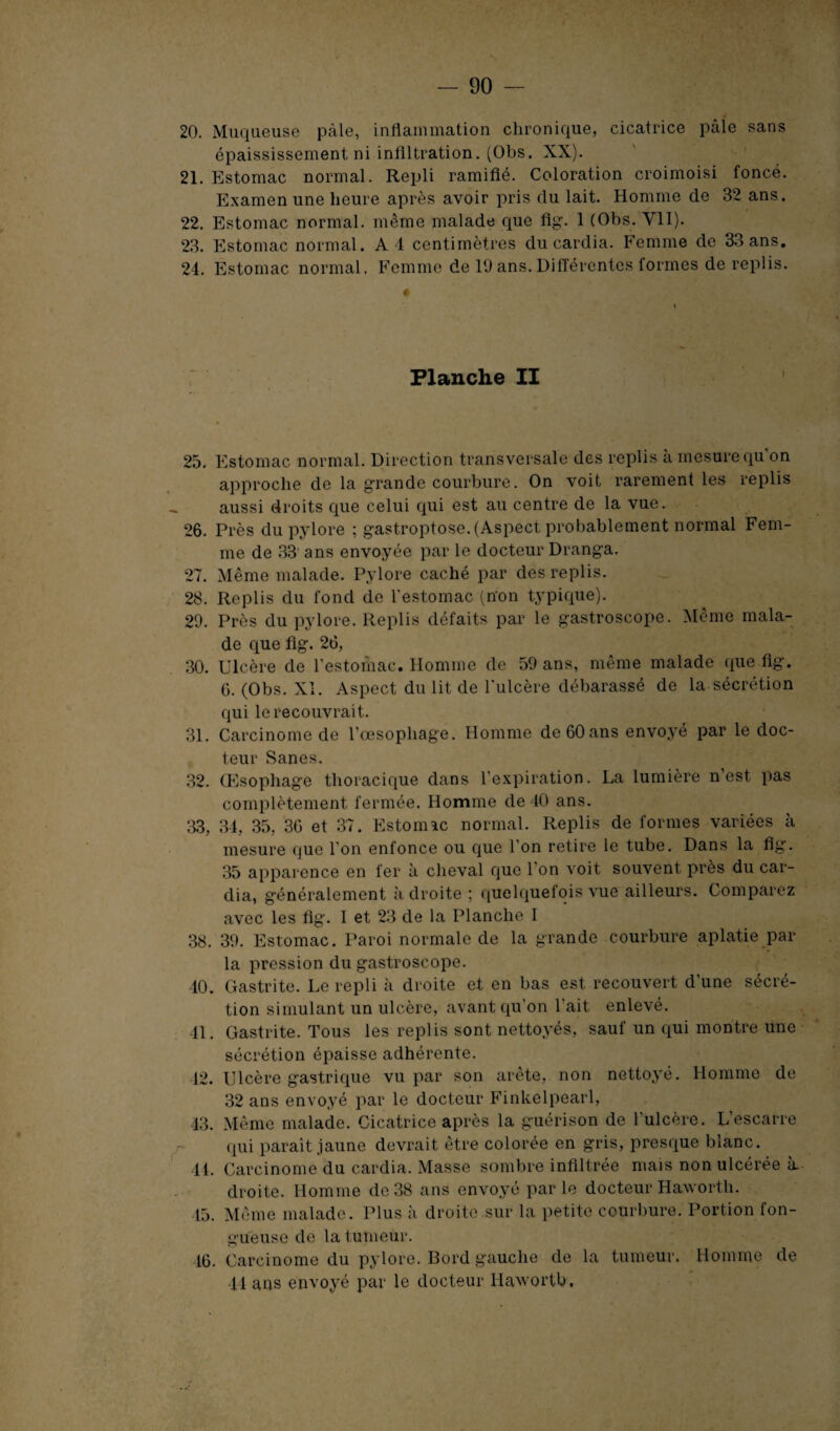 épaississement ni infiltration. (Obs. XX). 21. Estomac normal. Repli ramifié. Coloration croimoisi foncé. Examen une heure après avoir pris du lait. Homme de 32 ans. 22. Estomac normal, même malade que fig. 1 (Obs. VII). 23. Estomac normal. A 4 centimètres du cardia. Femme de 33 ans. 24. Estomac normal. Femme de 19 ans.Différentes formes de replis. Planche II 25. Estomac normal. Direction transversale des replis à mesure qu'on approche de la grande courbure. On voit rarement les replis aussi droits que celui qui est au centre de la vue. 26. Près du pylore ; gastroptose. (Aspect probablement normal Fem¬ me de 33 ans envoyée par le docteur Dranga. 27. Même malade. Pylore caché par des replis. 28. Replis du fond do l'estomac (non typique). 29. Près du pylore. Replis défaits par le gastroscope. Même mala¬ de que fig. 26, 30. Ulcère de l’estomac. Homme de 59 ans, même malade que fig. 6. (Obs. XI. Aspect du lit de l'ulcère débarassé de la sécrétion qui le recouvrait. 31. Carcinome de l’oesophage. Homme de 60ans envoyé par le doc¬ teur Sanes. 32. Œsophage thoracique dans l’expiration. La lumière n’est pas complètement fermée. Homme de 40 ans. 33. 34, 35, 36 et 37. Estomac normal. Replis de formes variées h mesure que l'on enfonce ou que l’on retire le tube. Dans la fig. 35 apparence en fer à cheval que l’on voit souvent près du car¬ dia, généralement à droite ; quelquefois vue ailleurs. Comparez avec les fig. I et 23 de la Planche I 38. 39. Estomac. Paroi normale de la grande courbure aplatie par la pression du gastroscope. 40. Gastrite. Le repli à droite et en bas est recouvert d'une sécré¬ tion simulant un ulcère, avant qu'on 1 ait enlevé. 41. Gastrite. Tous les replis sont nettoyés, sauf un qui montre une sécrétion épaisse adhérente. 42. Ulcère gastrique vu par son arête, non nettoyé. Homme de 32 ans envoyé par le docteur Finkelpearl, 43. Même malade. Cicatrice après la guérison de l'ulcère. L’escarre qui paraît jaune devrait être colorée en gris, presque blanc. 4L Carcinome du cardia. Masse sombre infiltrée niais non ulcérée à droite. Homme de 38 ans envoyé par le docteur Haworth. 45. Même malade. Plus à droite sur la petite courbure. Portion fon¬ gueuse de la tumeur. 16. Carcinome du pylore. Bord gauche de la tumeur. Homme de 41 ans envoyé par le docteur Haworth.