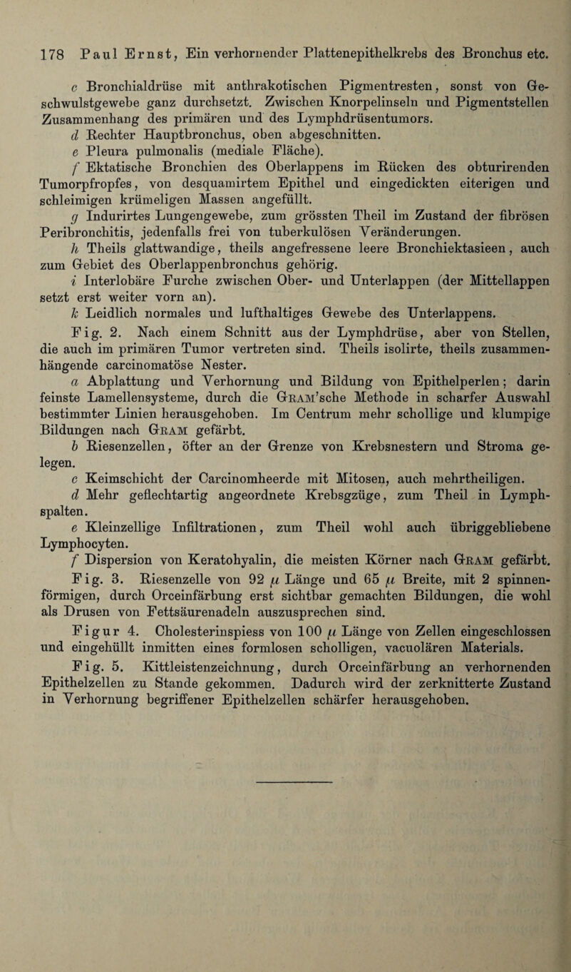 c Bronchialdriise mit anthrakotischen Pigmentresten, sonst von Ge- schwulstgewebe ganz durchsetzt. Zwischen Knorpelinseln und Pigmentstellen Zusammenhang des primaren und des Lymphdrusentumors. d Bechter Hauptbronchus, oben abgeschnitten. e Pleura pulmonalis (mediale Flache). f Ektatische Bronchien des Oberlappens im Biicken des obturirenden Tumorpfropfes, von desquamirtem Epithel und eingedickten eiterigen und schleimigen kriimeligen Massen angefiillt. g Indurirtes Lungengewebe, zum grossten Theil im Zustand der fibrosen Peribronchitis, jedenfalls frei von tuberkulosen Yeranderungen. h Theils glattwandige, theils angefressene leere Bronchiektasieen, auch zum Gebiet des Oberlappenbronchus gehorig. i Interlobare Purche zwischen Ober- und Unterlappen (der Mittellappen setzt erst weiter vorn an). k Leidlich normales und lufthaltiges Gewebe des Unterlappens. Fig. 2. Nach einem Schnitt aus der Lymphdriise, aber von Stellen, die auch im primaren Tumor vertreten sind. Theils isolirte, theils zusammen- hangende carcinomatose Nester. a Abplattung und Yerhornung und Bildung von Epithelperlen; darin feinste Lamellensysteme, durch die GEAM’sche Methode in scharfer Auswahl bestimmter Linien herausgehoben. Im Centrum mehr schollige und klumpige Bildungen nach Guam gefarbt. b Biesenzellen, ofter an der Grenze von Krebsnestern und Stroma ge- legen. c Keimschicht der Carcinomheerde mit Mitosen, auch mehrtheiligen. d Mehr geflechtartig angeordnete Krebsgziige, zum Theil in Lymph- spalten. e Kleinzellige Infiltrationen, zum Theil wohl auch iibriggebliebene Lymphocyten. f Dispersion von Keratohyalin, die meisten Korner nach Geam gefarbt. Fig. 3. Riesenzelle von 92 ^ Lange und 65 (ll Breite, mit 2 spinnen- formigen, durch Orceinfarbung erst sichtbar gemachten Bildungen, die wohl als Drusen von Fettsaurenadeln auszusprechen sind. Figur 4. Cholesterinspiess von 100 [i Lange von Zellen eingeschlossen und eingehiillt inmitten eines formlosen scholligen, vacuolaren Materials. Fig. 5. Kittleistenzeichnung, durch Orceinfarbung an verhornenden Epithelzellen zu Stande gekommen. Dadurch wird der zerknitterte Zustand in Yerhornung begriffener Epithelzellen scharfer herausgehoben.