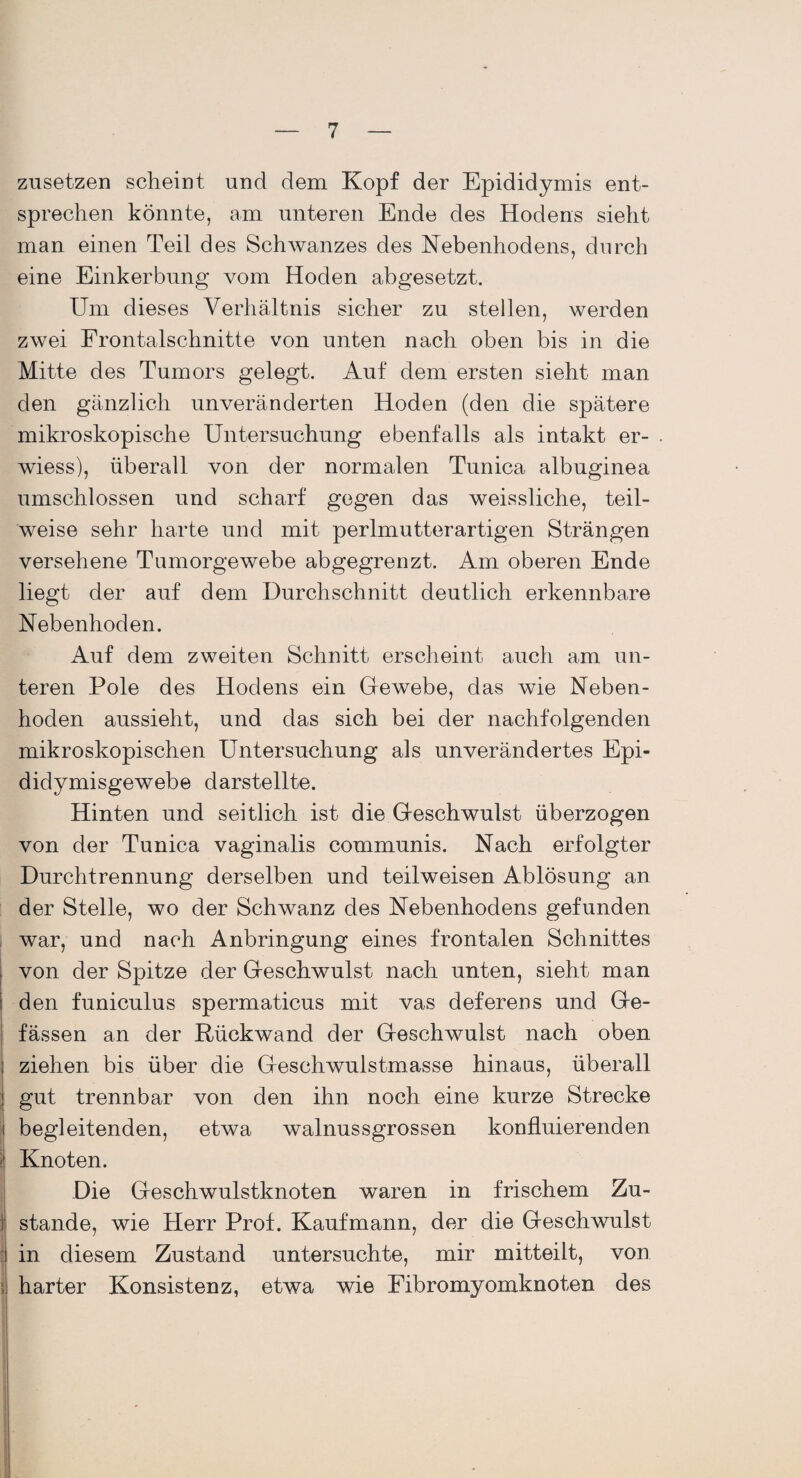 zusetzen scheint und dem Kopf der Epididymis ent¬ sprechen könnte, am unteren Ende des Hodens sieht man einen Teil des Schwanzes des Nebenhodens, durch eine Einkerbung vom Hoden abgesetzt. Um dieses Verhältnis sicher zu stellen, werden zwei Frontalschnitte von unten nach oben bis in die Mitte des Tumors gelegt. Auf dem ersten sieht man den gänzlich unveränderten Hoden (den die spätere mikroskopische Untersuchung ebenfalls als intakt er- wiess), überall von der normalen Tunica albuginea umschlossen und scharf gegen das weissliche, teil¬ weise sehr harte und mit perlmutterartigen Strängen versehene Tumorgewebe abgegrenzt. Am oberen Ende liegt der auf dem Durchschnitt deutlich erkennbare Nebenhoden. Auf dem zweiten Schnitt erscheint auch am un¬ teren Pole des Hodens ein Gewebe, das wie Neben¬ hoden aussieht, und das sich bei der nachfolgenden mikroskopischen Untersuchung als unverändertes Epi- didymisgewebe darstellte. Hinten und seitlich ist die Geschwulst überzogen von der Tunica vaginalis communis. Nach erfolgter Durchtrennung derselben und teilweisen Ablösung an der Stelle, wo der Schwanz des Nebenhodens gefunden war, und nach Anbringung eines frontalen Schnittes von der Spitze der Geschwulst nach unten, sieht man den funiculus spermaticus mit vas deferens und Ge- fässen an der Rückwand der Geschwulst nach oben f I ziehen bis über die Geschwulstmasse hinaus, überall J gut trennbar von den ihn noch eine kurze Strecke i begleitenden, etwa walnussgrossen konfluierenden | Knoten. Die Geschwulstknoten waren in frischem Zu- i stände, wie Herr Prof. Kaufmann, der die Geschwulst in diesem Zustand untersuchte, mir mitteilt, von harter Konsistenz, etwa wie Fibromyomknoten des