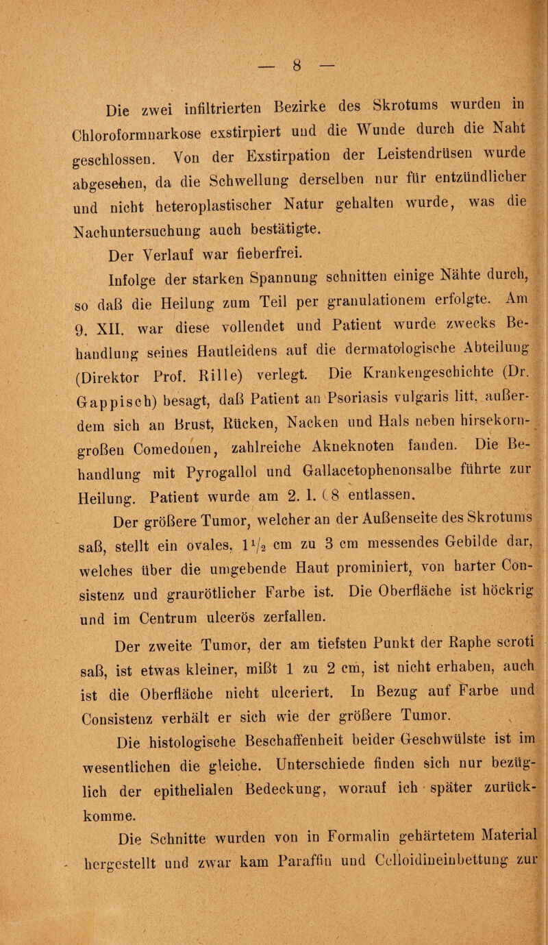 Die zwei infiltrierten Bezirke des Skrotums wurden in Chloroformnarkose exstirpiert und die Wunde durch die Naht geschlossen. Von der Exstirpation der Leistendrüsen wurde abgesehen, da die Schwellung derselben nur für entzündlicher und nicht heteroplastischer Natur gehalten wurde, was die Nachuntersuchung auch bestätigte. Der Verlauf war fieberfrei. Infolge der starken Spannung schnitten einige Nähte durch, so daß die Heilung zum Teil per granulationem erfolgte. Am 9. XII. war diese vollendet und Patient wurde zwecks Be¬ handlung seines Hautleidens auf die dermatologische Abteilung (Direktor Prof. Rille) verlegt. Die Krankengeschichte (Dr. Gappisch) besagt, daß Patient an Psoriasis vulgaris litt, außer¬ dem sich an Brust, Rücken, Nacken und Hals neben hirsekorn- großen Comedonen, zahlreiche Akneknoten fanden. Die Be¬ handlung mit Pyrogallol und Gallacetophenonsalbe führte zur Heilung. Patient wurde am 2. 1. ( 8 entlassen. Der größere Tumor, welcher an der Außenseite des Skrotums saß, stellt ein ovales, P/2 cm zu 3 cm messendes Gebilde dar, welches über die umgebende Haut prominiert, von harter Con- sistenz und graurötlicher Farbe ist. Die Oberfläche ist höckiig und im Centrum ulcerös zerfallen. Der zweite Tumor, der am tiefsten Punkt der Raphe scroti saß, ist etwas kleiner, mißt 1 zu 2 cm, ist nicht erhaben, auch ist die Oberfläche nicht ulceriert. In Bezug auf Farbe und Consistenz verhält er sich wie der größere Tumor. Die histologische Beschaffenheit beider Geschwülste ist im wesentlichen die gleiche. Unterschiede finden sich nur bezüg¬ lich der epithelialen Bedeckung, worauf ich später zurück¬ komme. Die Schnitte wurden von in Formalin gehärtetem Material hergestellt und zwar kam Paraffin und Ccdloidineinbettung zur