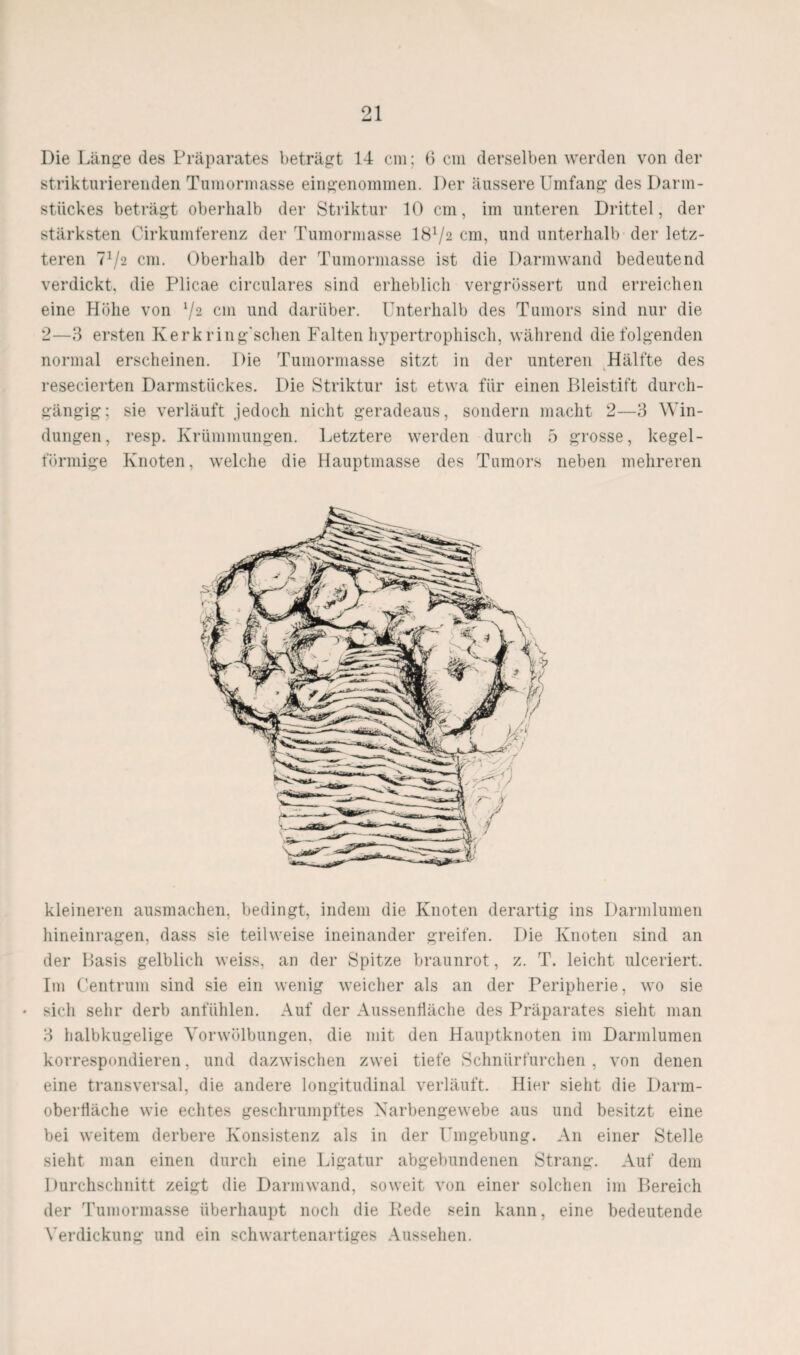 Die Länge des Präparates beträgt 14 cm; 6 cm derselben werden von der strikturierenden Tumormasse eingenommen. Der äussere Umfang des Darm- sti'ickes beträgt oberhalb der Striktur 10 cm, im unteren Drittel, der stärksten Cirkumferenz der Tumormasse I8V2 cm, und unterhalb der letz¬ teren V/2 cm. Oberhalb der Tumormasse ist die Darmwand bedeutend verdickt, die Plicae circulares sind erheblich vergrössert und erreichen eine Höhe von ‘/2 cm und darüber. Unterhalb des Tumors sind nur die 2—3 ersten Kerk ring'schen Falten hypertrophisch, während die folgenden normal erscheinen. Die Tumormasse sitzt in der unteren Hälfte des resecierten Darmstückes. Die Striktur ist etwa fiir einen Bleistift durch¬ gängig; sie verläuft jedoch nicht geradeaus, sondern macht 2—3 Win¬ dungen, resp. Krümmungen. Letztere werden durch 5 grosse, kegel¬ förmige Knoten, welche die Hauptmasse des Tumors neben mehreren kleineren ausmachen, bedingt, indem die Knoten derartig ins Darmlumen hineinragen, dass sie teilweise ineinander greifen. Die Knoten sind an der Basis gelblich weiss, an der Spitze braunrot, z. T. leicht ulceriert. Im Centrum sind sie ein wenig weicher als an der Peripherie, wo sie • sich sehr derb anfiihlen. Auf der Aussenfläche des Präparates sieht man 3 halbkugelige Yorwölbungen, die mit den Hauptknoten im Darmlumen korrespondieren, und dazwischen zwei tiefe Schniirfurchen , von denen eine transversal, die andere longitudinal verläuft. Hier sieht die Darm¬ oberfläche wie echtes geschrumpftes Karbengewebe aus und besitzt eine bei weitem derbere Konsistenz als in der Umgebung. An einer Stelle sieht man einen durch eine Ligatur abgebundenen Strang. Auf dem Durchschnitt zeigt die Darinwand, soweit von einer solchen im Bereich der Tumormasse überhaupt noch die Itede sein kann, eine bedeutende Verdickung und ein schwartenartiges Aussehen.