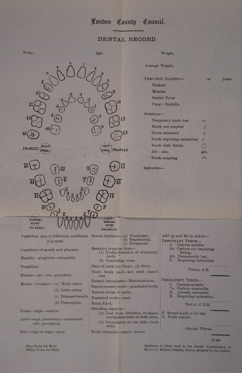 Xcrntratr Comfit; €omdl DENTAL RECORD. Name. Age, Weight. AP 4?., ENLARGED t right » 'jDNSIL / <s,s : urT\ 'jONSiLy/enlarged Average Weight. Previous Illness— at Rickets Measles Scarlet Fever Cong : Syphilis Symbols— Temporary tooth lost — Tooth not erupted Tooth extracted x Tooth requiring extraction / Tooth with fistula © Alv : abs. Tooth erupting o abs. /\ 5© 0 12lCP °o'6'6Jo0 0 ^(9 T _ ft) V- fJ/7) 15 Remarks- 13 111 m j i i ,SUBMAX.' *£LAND.' ENLARCED / UFT\ *,SUBMAX. »GLAND/ ENLARGED Underline any of following conditions, Sound dentition—(a) Temporary. (6) Transitional. (c) Permanent. Retarded eruption from— (1) Undue detention of temporary if present. Condition of mouth and pharynx. Healthy —gingivitis—stomatitis. Tonsillitis. Fistulae—alv : abs., pyorrhoea. Mouth—breather—(a) Much caries (/>) Little caries. Palate—high—narrow. Arch—supr. protrusion—contracted infr. protrusion. teeth. (2) Protruding roots. State of teeth (a) Clean ; (b) Dirty. Tooth brush used—not used—hasn’t one. Enamel hypoplastic—Hutchinsonian. Supernumerary teeth—geminated teeth. Natural arrest of caries. (c) Enlarged tonsils Fractured teeth-\-cause. (d) Pharyngitis. , Teeth filled. Grinding capacity— (a) Lost from defective or absent contiguous teeth on both sides. (b) Irregularity on one side—both Add up and fill in below— Temporary Teeth— A. Carious savable. Aa. Carious not requiring fitting. Ab. Prematurely lost. B. Requiring extraction. Total A.B. Bite—edge to edge—open. Blue Form for Boys. White Form for Girls. sides. Teeth irregular—upper—lower. Permanent Teeth— C. Carious savable. Ca. Carious unsavable. D. Already extracted, E. Requiring extraction. Total C.D.E. F. Sound teeth to be lost. G. Teeth absent. Grand Total years. [B 449 Specimen of Chart used in the Dental Examination i the L.C.C. Michael Faraday School, designed by the Authc