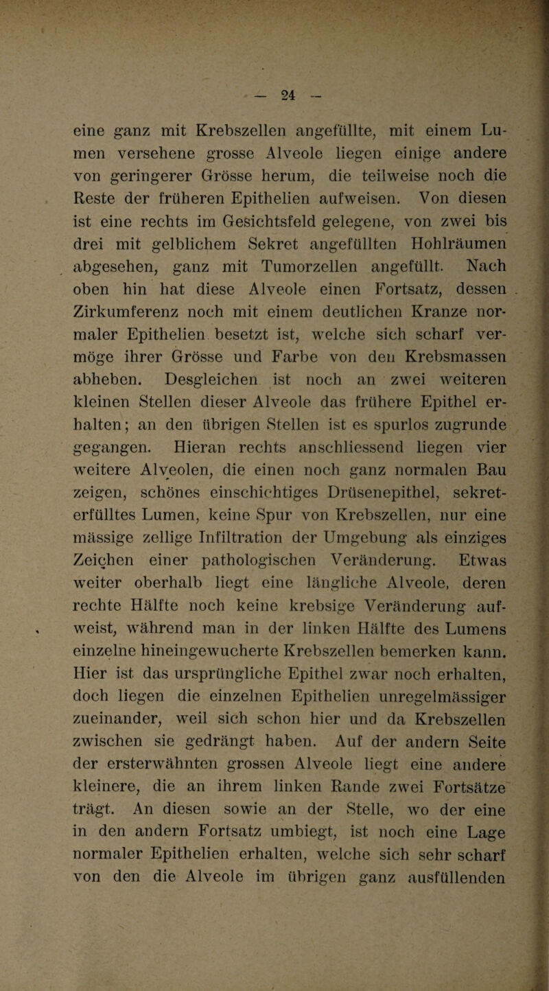 eine ganz mit Krebszellen angefüllte, mit einem Lu¬ men versehene grosse Alveole liegen einige andere von geringerer Grösse herum, die teilweise noch die Reste der früheren Epithelien auf weisen. Von diesen ist eine rechts im Gesichtsfeld gelegene, von zwei bis drei mit gelblichem Sekret angefüllten Hohlräumen abgesehen, ganz mit Tumorzellen angefüllt. Nach oben hin hat diese Alveole einen Fortsatz, dessen . Zirkumferenz noch mit einem deutlichen Kranze nor¬ maler Epithelien besetzt ist, welche sich scharf ver¬ möge ihrer Grösse und Farbe von den Krebsmassen abheben. Desgleichen ist noch an zwei weiteren kleinen Stellen dieser Alveole das frühere Epithel er¬ halten ; an den übrigen Stellen ist es spurlos zugrunde gegangen. Hieran rechts anschliessend liegen vier weitere Alveolen, die einen noch ganz normalen Bau zeigen, schönes einschichtiges Drüsenepithel, sekret¬ erfülltes Lumen, keine Spur von Krebszellen, nur eine massige zellige Infiltration der Umgebung als einziges Zeichen einer pathologischen Veränderung. Etwas weiter oberhalb liegt eine längliche Alveole, deren rechte Hälfte noch keine krebsige Veränderung auf¬ weist, während man in der linken Hälfte des Lumens einzelne hineingewucherte Krebszellen bemerken kann. Hier ist das ursprüngliche Epithel zwar noch erhalten, doch liegen die einzelnen Epithelien unregelmässiger zueinander, weil sich schon hier und da Krebszellen zwischen sie gedrängt haben. Auf der andern Seite der ersterwähnten grossen Alveole liegt eine andere kleinere, die an ihrem linken Rande zwei Fortsätze trägt. An diesen sowie an der Stelle, wo der eine in den andern Fortsatz umbiegt, ist noch eine Lage normaler Epithelien erhalten, welche sich sehr scharf von den die Alveole im übrigen ganz ausfüllenden 'f'