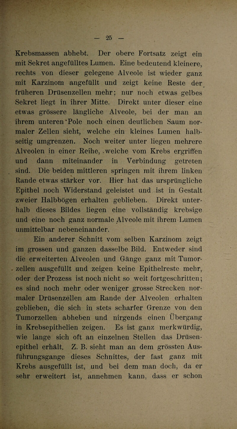 ' Krebsmassen abhebt. Der obere Fortsatz zeigt ein mit Sekret angefülltes Lumen. Eine bedeutend kleinere, rechts von dieser gelegene Alveole ist wieder ganz mit Karzinom angefüllt und zeigt keine Reste der früheren Drüsenzellen mehr; nur noch etwas gelbes Sekret liegt in ihrer Mitte. Direkt unter dieser eine etwas grössere längliche Alveole, bei der man an ihrem unteren‘Pole noch einen deutlichen Saum nor¬ maler Zellen sieht, welche ein kleines Lumen halb¬ seitig umgrenzen. Noch weiter unter liegen mehrere Alveolen in einer Reihe, .welche vom Krebs ergriffen und dann miteinander in Verbindung getreten sind. Die beiden mittleren springen mit ihrem linken Rande etwas stärker vor. Hier hat das ursprüngliche Epithel noch Widerstand geleistet und ist in Gestalt zweier Halbbögen erhalten geblieben. Direkt unter¬ halb dieses Bildes liegen eine vollständig krebsige und eine noch ganz normale Alveole mit ihrem Lumen unmittelbar nebeneinander. Ein anderer Schnitt vom selben Karzinom zeigt im grossen und ganzen dasselbe Bild. Entweder sind die erweiterten Alveolen und Gänge ganz mit Tumor¬ zellen ausgefüllt und zeigen keine Epithelreste mehr, oder der Prozess ist noch nicht so weit fortgeschritten; es sind noch mehr oder weniger grosse Strecken nor¬ maler Drüsenzellen am Rande der Alveolen erhalten geblieben, die sich in stets scharfer Grenze von den Tumorzellen abheben und nirgends einen Übergang in Krebsepithelien zeigen. Es ist ganz merkwürdig, wie lange sich oft an einzelnen Stellen das Drüsen¬ epithel erhält. Z. B. sieht man an dem grössten Aus¬ führungsgange dieses Schnittes, der fast ganz mit Krebs ausgefüllt ist, und bei dem man doch, da er sehr erweitert ist, annehmen kann, dass er schon