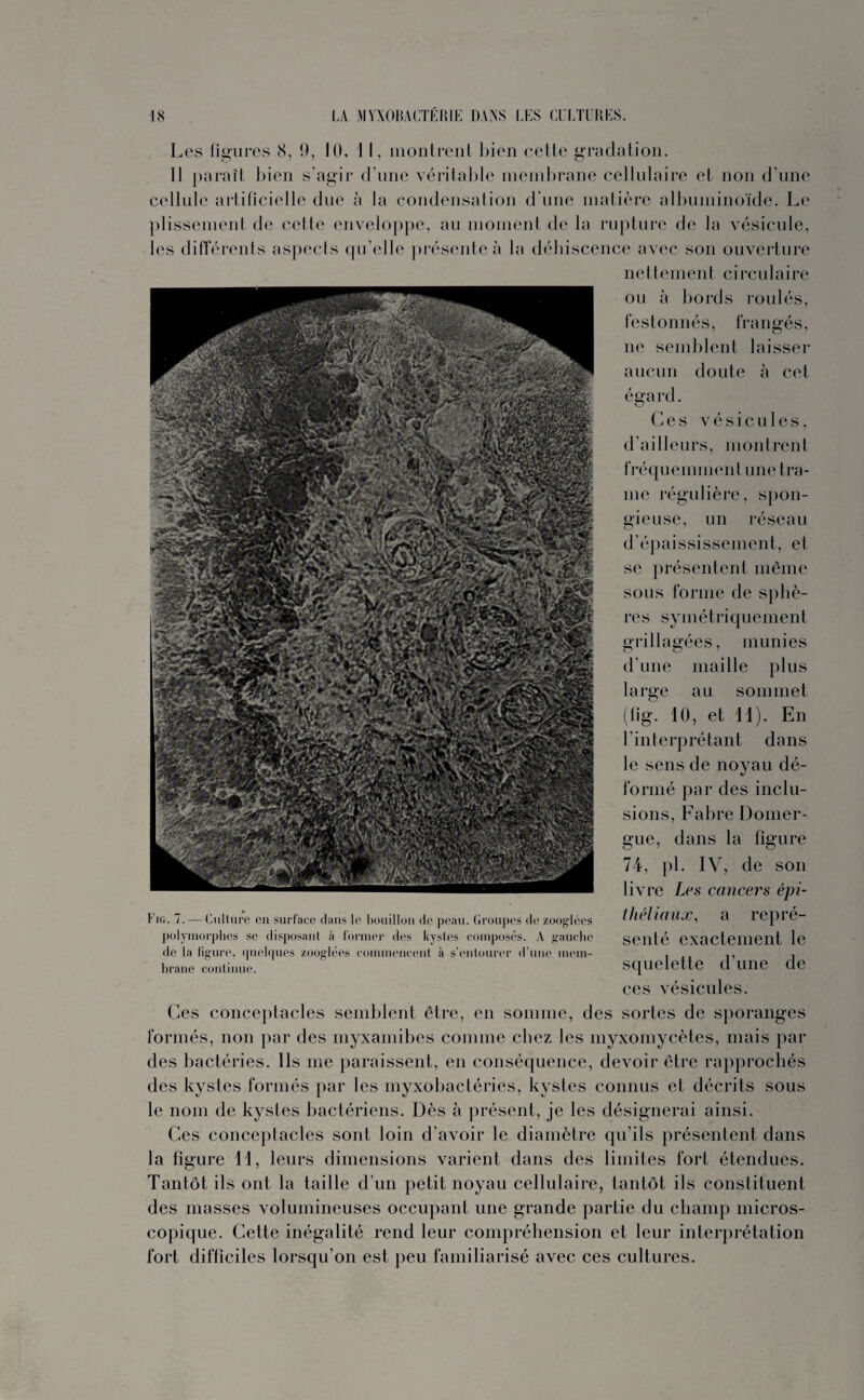 Les figures 8, 9, 10, J I, montrent bien cette gradation. 11 paraît bien s’agir d’une véritable membrane cellulaire et non d’une cellule artificielle due à la condensation d'une matière albuminoïde. Le plissement de cette enveloppe, au moment de la rupture de la vésicule, les différents aspects qu’elle présente à la déhiscence avec son ouverture Fig. 7. — Culture en surface dans le bouillon de peau. Groupes de zooglées polymorphes se disposant à former des kystes composés. A gauche de la figure, quelques zooglées commencent à s’entourer d’une mem¬ brane continue. nettement circulaire ou à bords roulés, festonnés, frangés, ne semblent laisser aucun doute à cet égard. O Ces vésicules, d’ailleurs, montrent fr é q u e m m e n I u n e t r a - me régulière, spon¬ gieuse, un réseau d’épaississement, et se présentent même sous forme de sphè¬ res symétriquement grillagées, munies d’une maille plus large au sommet (fig. 10, et 11). En l’interprétant dans le sens de noyau dé¬ formé par des inclu¬ sions, Fabre Domer¬ gue, dans la figure 74, pi. IV, de son livre Les cancers épi¬ théliaux, a repré¬ senté exactement le squelette d’une de ces vésicules. Ces conceptacles semblent être, en somme, des sortes de sporanges formés, non par des myxamibes comme chez les myxomycètes, mais par des bactéries. Ils me paraissent, en conséquence, devoir être rapprochés des kystes formés par les myxobactéries, kystes connus et décrits sous le nom de kystes bactériens. Dès à présent, je les désignerai ainsi. Ces conceptacles sont loin d’avoir le diamètre qu’ils présentent dans la figure 11, leurs dimensions varient dans des limites fort étendues. Tantôt ils ont la taille d’un petit noyau cellulaire, tantôt ils constituent des masses volumineuses occupant une grande partie du champ micros¬ copique. Cette inégalité rend leur compréhension et leur interprétation fort difficiles lorsqu’on est peu familiarisé avec ces cultures.