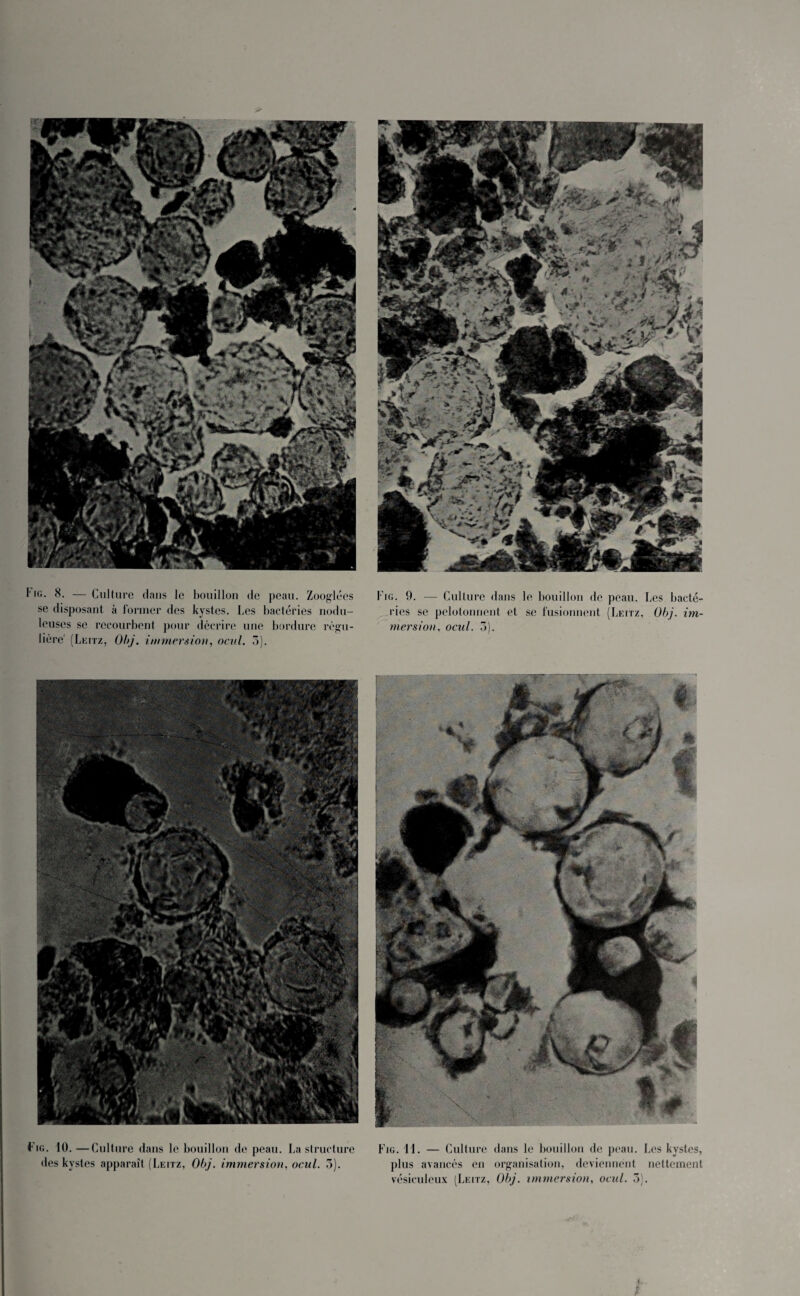 se disposant à former des kystes. Les bactéries nodu- leuses se recourbent pour décrire une bordure régu¬ lière' (Leitz, Obj. immersion, ocul. 3). ries se pelotonnent et se fusionnent (Leitz, Obj. im¬ mersion, ocul. 3). Fig. 10.—Culture dans le bouillon de peau. La structure des kystes apparaît (Leitz, Obj. immersion, ocul. 3). Fig. 11. — Culture dans le bouillon de peau. Les kystes, plus avancés en organisation, deviennent nettement vésiculeux (Leitz, Obj. immersion, ocul. 3).
