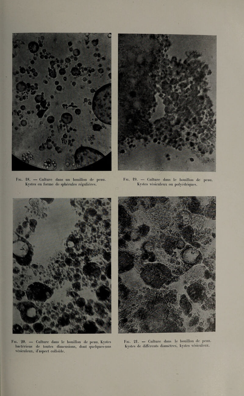 Kystes en forme de sphérules régulières. Kystes vésiculeux ou polyédriques. Fig. 20. — bactériens vésiculeux, Culture dans le bouillon de peau. Kystes de toutes dimensions, dont quelques-uns d’aspect colloïde. Fig. 21. — Culture dans le bouillon de peau. Kystes de différents diamètres, kystes vésiculeux.