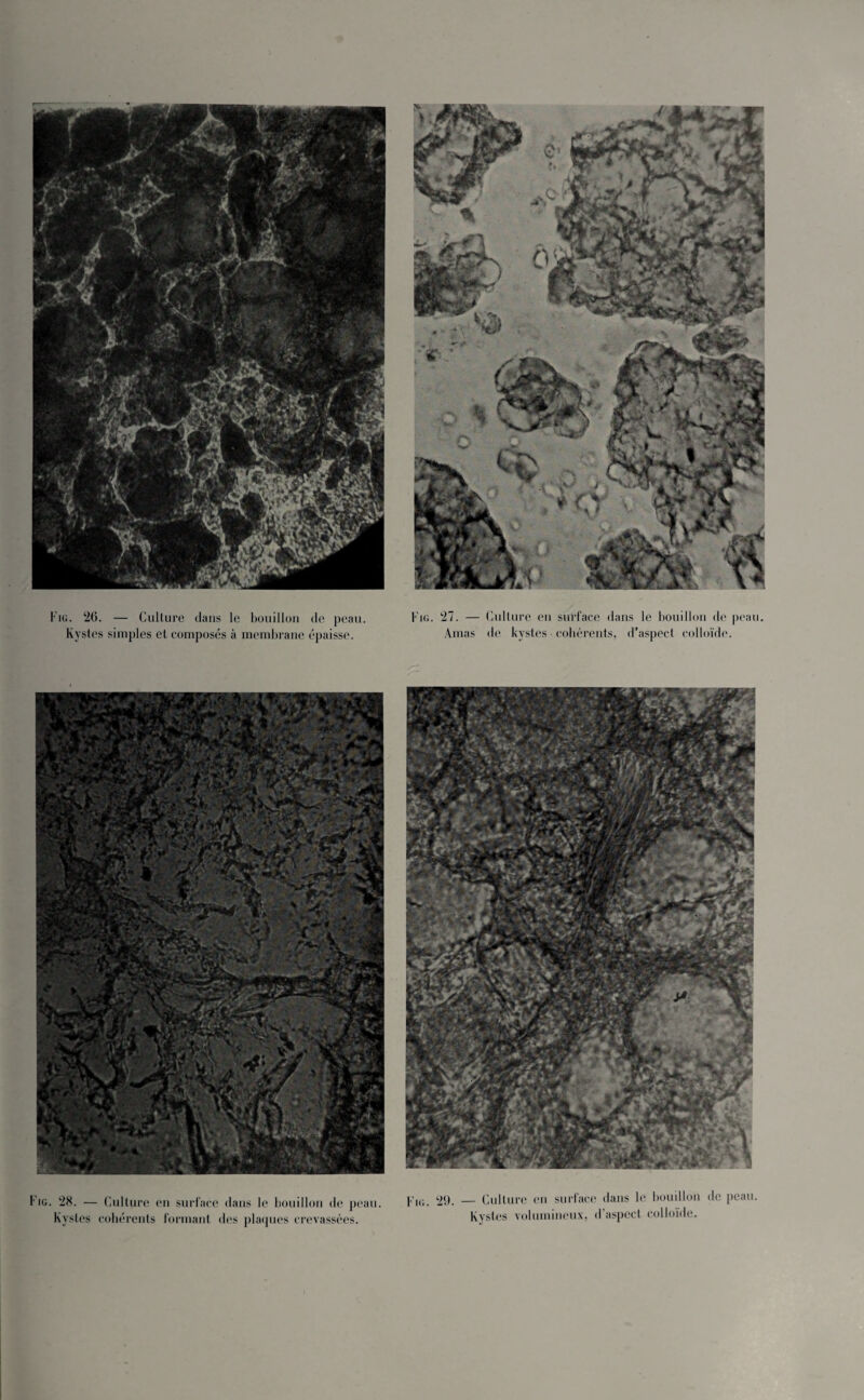 Kystes simples et composés à membrane épaisse. Amas de kystes cohérents, d’aspect colloïde. Fig. 28. — Culture en surface dans le bouillon de peau. Kystes cohérents formant des plaques crevassées. IG. 29. - Culture en surface dans le bouillon de peau. Kystes volumineux, d’aspect colloïde.
