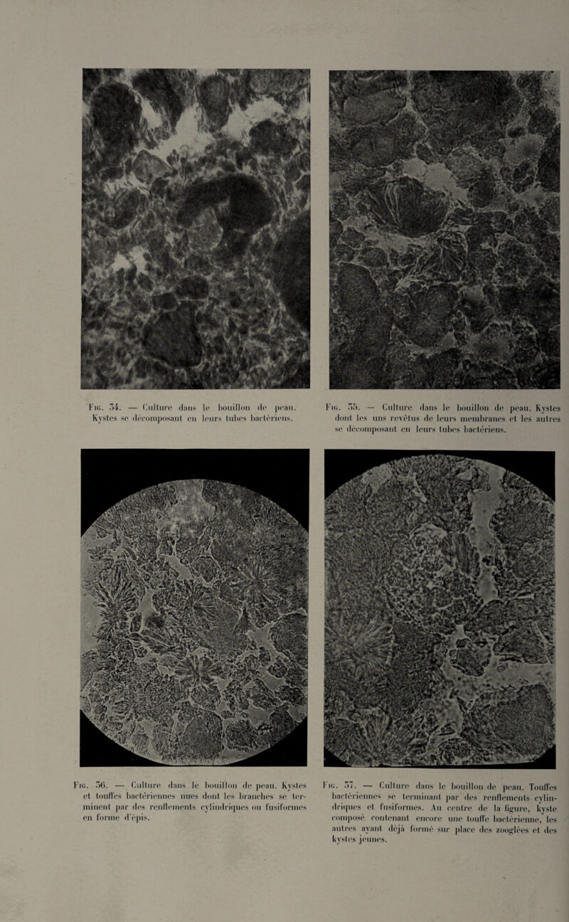 Kystes se décomposant en leurs tubes bactériens. dont les uns revêtus de leurs membranes et les autres se décomposant en leurs tubes bactériens. Fig. 3(1. — Culture dans le bouillon de peau. Kystes et touffes bactériennes nues dont les branches se ter¬ minent par des rendements cylindriques ou fusiformes en forme d’épis. F ig. 37. — Culture dans le bouillon de peau. Touffes bactériennes se terminant par dos renflements cylin¬ driques cl fusiformes. Au centre de la figure, kyste composé contenant encore une touffe bactérienne, les autres ayant déjà formé sur place des zooglées et des kystes jeunes.
