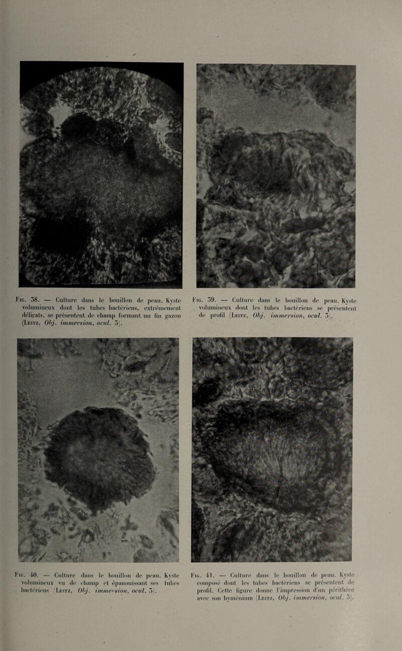 volumineux dont les tubes bactériens, extrêmement déliqats, se présentent de champ formant un fin gazon (Leitz, Obj. immersion, ocul. 5). volumineux dont les tubes bactériens se présentent de profil (Leitz, Obj. immersion, ocul. 5). Fig. 40. — Culture dans le bouillon de peau. Kvstc volumineux vu de champ et épanouissant ses tubes bactériens (Leitz, Obj. immersion, ocul. 5). Fig. 4). — Culture dans le bouillon de peau. Kyste composé dont les tubes bactériens se présentent île profil. Cette figure donne l'impression d’un périthèce