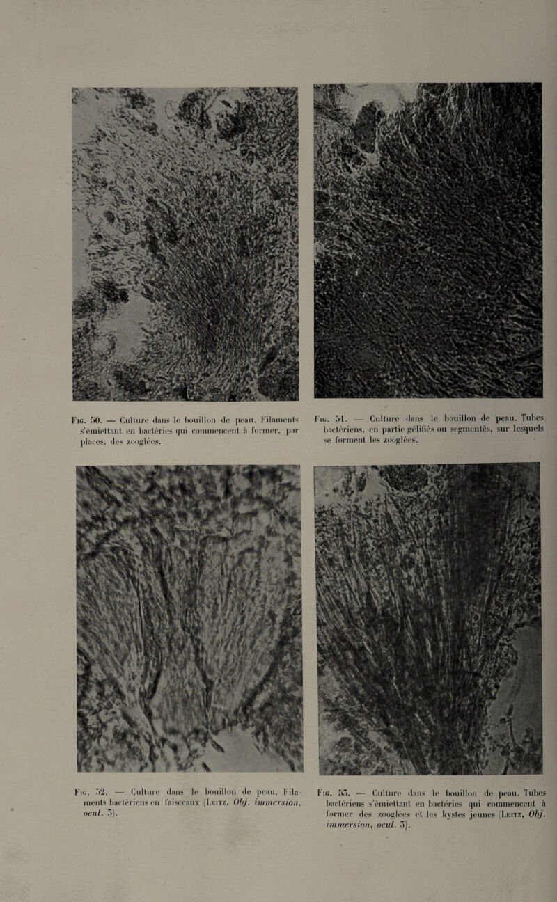 s’émiettant en bactéries qui commencent à former, par places, des zooglées. bactériens, en partie gélifiés ou segmentés, sur lesquels se forment les zooglées. Fig. 52. — Culture dans le bouillon de peau. Fila¬ ments bactériens en faisceaux (Leitz, Obj. immersion, ocul. 5). Fig. 55. — Culture dans le bouillon de peau. Tubes bactériens s’émiettant en bactéries qui commencent à former des zooglées et les kystes jeunes (Leitz, Obj.