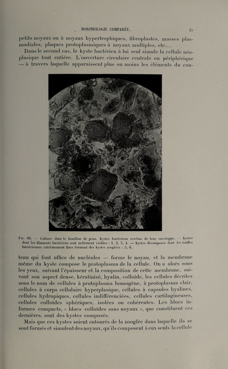 petits noyaux ou à' noyaux hypertrophiques, fihroplastes, masses plas- modiales, plaques protoplasmiques à noyaux multiples, etc.... Dans le second cas, le kyste bactérien à lui seul simule la cellule néo¬ plasique tout entière. L’ouverture circulaire centrale ou périphérique — à travers laquelle apparaissent plus ou moins les éléments du con- Fig. 69. — Culture dans le bouillon de peau. Kystes bactériens revêtus de leur enveloppe. — Kystes dont les filaments bactériens sont nettement visibles : 1, 2, 5, 4. — Kystes décomposés dont les touffes bactériennes extrêmement fines forment des kystes zoog-lées : 5, 6. tenu qui font office de nucléoles — forme le noyau, et la membrane même du kyste compose le protoplasma de la cellule. On a alors sous les yeux, suivant l’épaisseur et la composition de cette membrane, sui¬ vant son aspect dense, kératinisé, hyalin, colloïde, les cellules décrites sous le nom de cellules à protoplasma homogène, à protoplasma clair, cellules à corps cellulaire hyperplasique, cellules à capsules hyalines, cellules hydropiques, cellules indifférenciées, cellules cartilagineuses, cellules colloïdes sphériques, isolées ou cohérentes. Les blocs in¬ formes compacts, « blocs colloïdes sans noyaux », que constituent ces dernières, sont des kystes composés. Mais que ces kystes soient entourés de la zooglée dans laquelle ils se sont formés et simulent des noyaux, qu’ils composent à eux seuls la cellule
