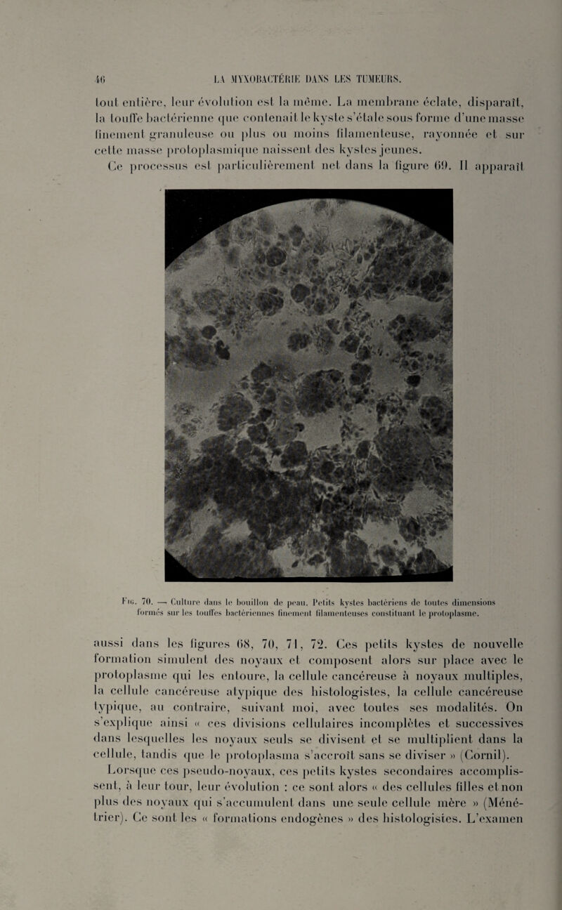 tout entière, leur évolution est la même. La membrane éclate, disparaît, la touffe bactérienne que contenait le kyste s’étale sous forme d’une masse finement granuleuse ou plus ou moins filamenteuse, rayonnée et sur celte masse protoplasmique naissent des kystes jeunes. Ce processus est particulièrement net dans la figure 69. Il apparaît ig. 70. —- Culture dans le bouillon de peau. Petits kystes bactériens de toutes dimensions formés sur les touffes bactériennes finement filamenteuses constituant le protoplasme. aussi dans les figures 68, 70, 71, 72. Ces petits kystes de nouvelle formation simulent des noyaux et composent alors sur place avec le protoplasme qui les entoure, la cellule cancéreuse à noyaux multiples, la cellule cancéreuse atypique des histologistes, la cellule cancéreuse typique, au contraire, suivant moi, avec toutes ses modalités. On s’explique ainsi « ces divisions cellulaires incomplètes et successives dans lesquelles les noyaux seuls se divisent et se multiplient dans la cellule, tandis que le protoplasma s’accroît sans se diviser » (Cornil). Lorsque ces pseudo-noyaux, ces petits kystes secondaires accomplis¬ sent, à leur tour, leur évolution : ce sont alors « des cellules filles et non plus des noyaux qui s’accumulent dans une seule cellule mère » (Méné¬ trier). Ce sont les « formations endogènes » des histologistes. L’examen