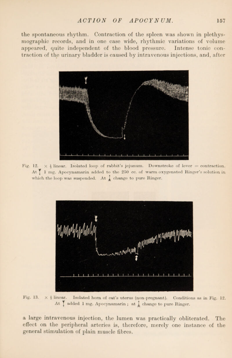 the spontaneous rhythm. Contraction of the spleen was shown in plethys- mographic records, and in one case wide, rhythmic variations of volume appeared, quite independent of the blood pressure. Intense tonic con¬ traction of the urinary bladder is caused by intravenous injections, and, after Fig. 12. x ^ linear. Isolated loop of rabbit’s jejunum. Downstroko of lever = contraction. At ^ 1 mg. Apocynamarin added to the 250 cc. of warm oxygenated Ringer’s solution in which the loop was suspended. At change to pure Ringer. Fig. 13. X 1 linear. Isolated horn of cat’s uterus (non-pregnant). Conditions as in Fig. 12. ,'namarm ; at I change to pure Ringer. a large intravenous injection, the lumen was practically obliterated. The effect on the peripheral arteries is, therefore, merely one instance of the general stimulation of plain muscle fibres.