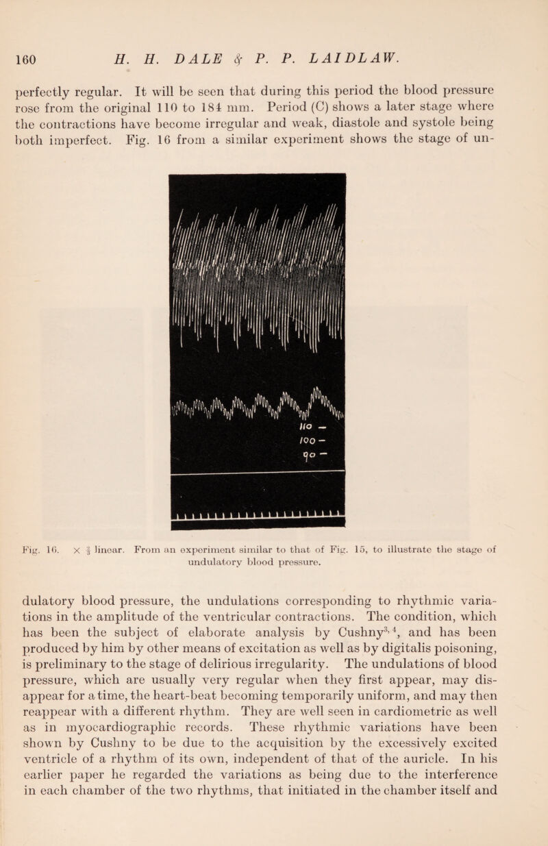 perfectly regular. It will be seen that during this period the blood pressure rose from the original 110 to 184 mm. Period (C) shows a later stage where the contractions have become irregular and weak, diastole and systole being both imperfect. Fig. 16 from a similar experiment shows the stage of un- Fig. 10. X | linear. From an experiment similar to that of Fig. 15, to illustrate the stage of undulatory blood pressure. dulatory blood pressure, the undulations corresponding to rhythmic varia¬ tions in the amplitude of the ventricular contractions. The condition, which has been the subject of elaborate analysis by Cushny3’4, and has been produced by him by other means of excitation as well as by digitalis poisoning, is preliminary to the stage of delirious irregularity. The undulations of blood pressure, which are usually very regular when they first appear, may dis¬ appear for a time, the heart-beat becoming temporarily uniform, and may then reappear with a different rhythm. They are well seen in cardiometric as well as in myocardiographic records. These rhythmic variations have been shown by Cushny to be due to the acquisition by the excessively excited ventricle of a rhythm of its own, independent of that of the auricle. In his earlier paper he regarded the variations as being due to the interference in each chamber of the two rhythms, that initiated in the chamber itself and