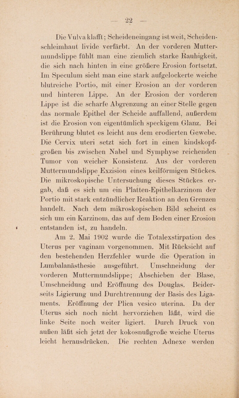 Die Vulva klafft; Scheideneingang ist weit, Scheideu¬ schleimhaut livide verfärbt. An der vorderen Mutter¬ mundslippe fühlt man eine ziemlich starke Rauhigkeit, die sich nach hinten in eine größere Erosion fortsetzt. Im Speculum sieht man eine stark aufgelockerte weiche blutreiche Portio, mit einer Erosion an der vorderen und hinteren Lippe. An der Erosion der vorderen Lippe ist die scharfe Abgrenzung an einer Stelle gegen das normale Epithel der Scheide auffallend, außerdem ist die Erosion von eigentümlich speckigem Glanz. Bei Berührung blutet es leicht aus dem erodierten Gewebe. Die Cervix uteri setzt sich fort in einen kindskopf¬ großen bis zwischen Nabel und Symphyse reichenden Tumor von weicher Konsistenz. Aus der vorderen Muttermundslippe Exzision eines keilförmigen Stückes. Die mikroskopische Untersuchung dieses Stückes er¬ gab, daß es sich um ein Platten-Epithelkarzinom der Portio mit stark entzündlicher Reaktion an den Grenzen handelt. Nach dem mikroskopischen Bild scheint es sich um ein Karzinom, das auf dem Boden einer Erosion entstanden ist, zu handeln. Am 2. Mai 1902 wurde die Totalexstirpation des Uterus per vaginam vorgenommen. Mit Rücksicht auf den bestehenden Herzfehler wurde die Operation in Lumbalanästhesie ausgeführt. Umschneidung der vorderen Muttermundslippe; Abschieben der Blase, Umschneidung und Eröffnung des Douglas. Beider¬ seits Ligierung und Durchtrennung der Basis des Liga¬ ments. Eröffnung der Plica vesico uterina. Da der Uterus sich noch nicht hervorziehen läßt, wird die linke Seite noch weiter ligiert. Durch Druck von außen läßt sich jetzt der kokosnußgroße weiche Uterus leicht herausdrücken. Die rechten Adnexe werden