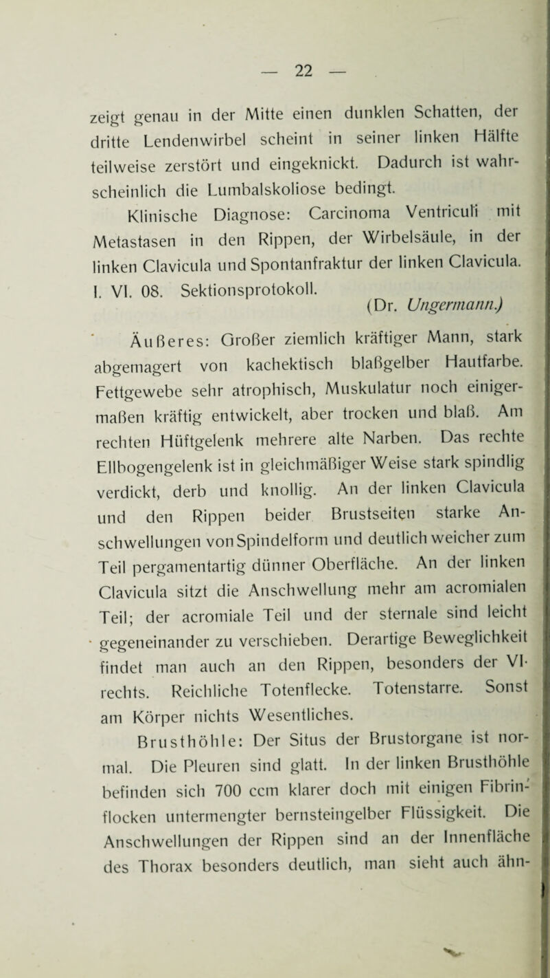zeigt genau in der Mitte einen dunklen Schatten, der dritte Lendenwirbel scheint in seiner linken Hälfte teilweise zerstört und eingeknickt. Dadurch ist wahr¬ scheinlich die Lumbalskoliose bedingt. Klinische Diagnose: Carcinoma Ventriculi mit Metastasen in den Rippen, der Wirbelsäule, in der linken Clavicula und Spontanfraktur der linken Clavicula. I. VI. 08. Sektionsprotokoll. (Dr. Ungermann.) Äußeres: Großer ziemlich kräftiger Mann, stark abgemagert von kachektisch blaßgelber Hautfarbe. Fettgewebe sehr atrophisch, Muskulatur noch einiger¬ maßen kräftig entwickelt, aber trocken und blaß. Am rechten Hüftgelenk mehrere alte Narben. Das rechte Ellbogengelenk ist in gleichmäßiger Weise stark spindlig verdickt, derb und knollig. An der linken Clavicula und den Rippen beider Brustseiten starke An¬ schwellungen von Spindelform und deutlich weicher zum Teil pergamentartig dünner Oberfläche. An der linken Clavicula sitzt die Anschwellung mehr am acromialen Teil; der acromiale Teil und der sternale sind leicht • gegeneinander zu verschieben. Derartige Beweglichkeit findet man auch an den Rippen, besonders der VI- rechts. Reichliche Totenflecke. Totenstarre. Sonst am Körper nichts Wesentliches. Brusthöhle: Der Situs der Brustorgane ist nor¬ mal. Die Pleuren sind glatt. In der linken Brusthöhle befinden sich 700 ccm klarer doch mit einigen Fibrin¬ flocken untermengter bernsteingelber Flüssigkeit. Die Anschwellungen der Rippen sind an der Innenfläche des Thorax besonders deutlich, man sieht auch ähn-