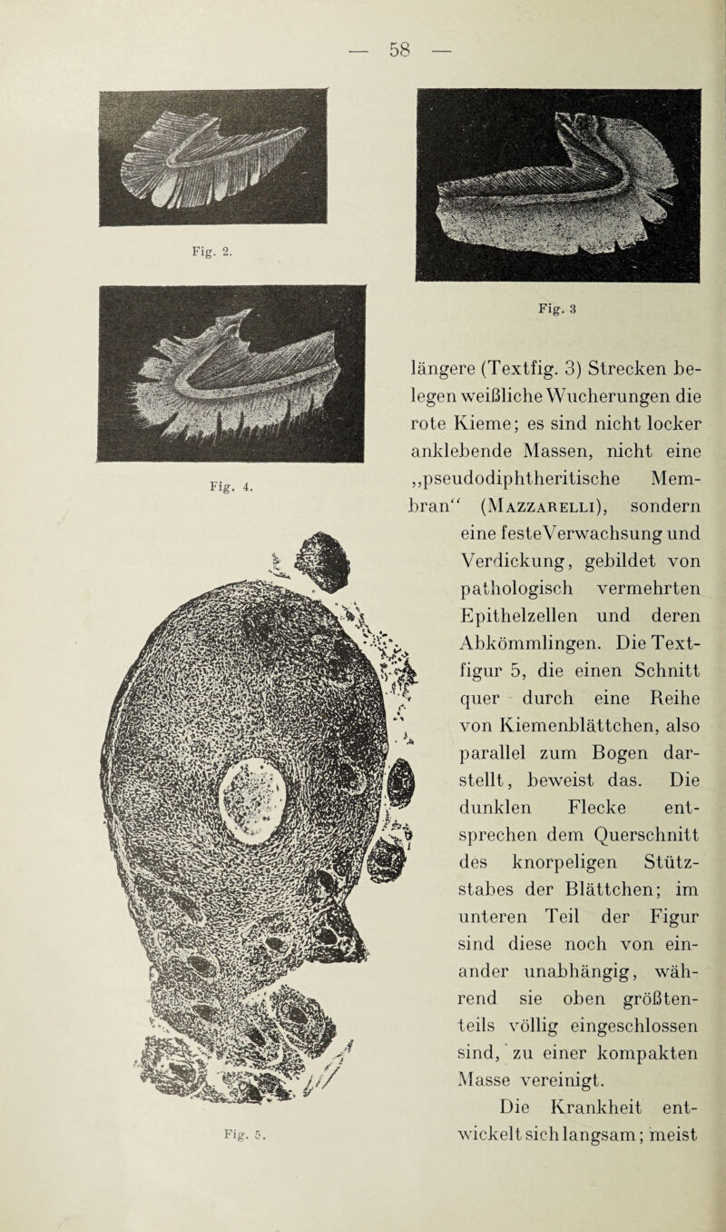 Fig. 4. Fig. Fig. 3 längere (Textfig. 3) Strecken be¬ legen weißliche Wucherungen die rote Kieme; es sind nicht locker anklebende Massen, nicht eine ,,pseudodiphtheritische Mem¬ bran (Mazzarelli), sondern eine festeVerwachsung und Verdickung, gebildet von pathologisch vermehrten Epithelzellen und deren Abkömmlingen. Die Text¬ figur 5, die einen Schnitt quer durch eine Reihe von Kiemenblättchen, also parallel zum Bogen dar¬ stellt , beweist das. Die dunklen Flecke ent¬ sprechen dem Querschnitt des knorpeligen Stütz¬ stabes der Blättchen; im unteren Teil der Figur sind diese noch von ein¬ ander unabhängig, wäh¬ rend sie oben größten¬ teils völlig eingeschlossen sind, zu einer kompakten Masse vereinigt. Die Krankheit ent¬ wickelt sich langsam; meist