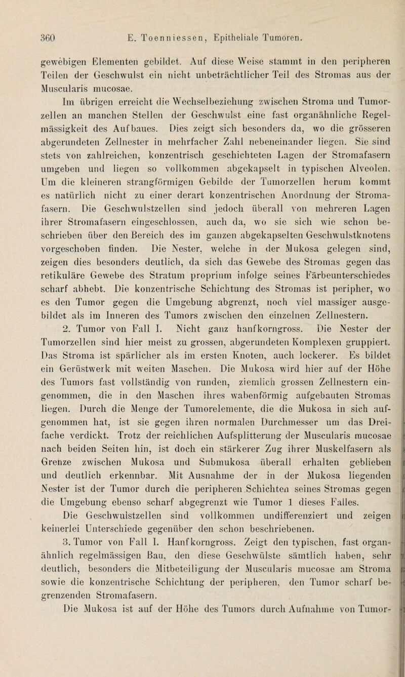 gewebigen Elementen gebildet. Auf diese Weise stammt in den peripheren Teilen der Geschwulst ein nicht unbeträchtlicher Teil des Stromas aus der Muscularis mucosae. Im übrigen erreicht die Wechselbeziehung zwischen Stroma und Tumor- zellen an manchen Stellen der Geschwulst eine fast organähnliche Regel¬ mässigkeit des Aufbaues. Dies zeigt sich besonders da, wo die grösseren abgerundeten Zellnester in mehrfacher Zahl nebeneinander liegen. Sie sind stets von zahlreichen, konzentrisch geschichteten Lagen der Stromafasern umgeben und liegen so vollkommen abgekapselt in typischen Alveolen. Um die kleineren strangförmigen Gebilde der Tumorzellen herum kommt es natürlich nicht zu einer derart konzentrischen Anordnung der Stroma¬ fasern. Die Geschwulstzellen sind jedoch überall von mehreren Lagen ihrer Stromafasern eingeschlossen, auch da, wo sie sich wie schon be¬ schrieben über den Bereich des im ganzen abgekapselten Geschwulstknotens vorgeschoben finden. Die Nester, welche in der Mukosa gelegen sind, zeigen dies besonders deutlich, da sich das Gewebe des Stromas gegen das retikuläre Gewebe des Stratum proprium infolge seines Färbeunterschiedes scharf abhebt. Die konzentrische Schichtung des Stromas ist peripher, wo es den Tumor gegen die Umgebung abgrenzt, noch viel massiger ausge¬ bildet als im Inneren des Tumors zwischen den einzelnen Zellnestern. 2. Tumor von Fall I. Nicht ganz hanfkorngross. Die Nester der Tumorzellen sind hier meist zu grossen, abgerundeten Komplexen gruppiert. Das Stroma ist spärlicher als im ersten Knoten, auch lockerer. Es bildet ein Gerüstwerk mit weiten Maschen. Die Mukosa wird hier auf der Höhe des Tumors fast vollständig von runden, ziemlich grossen Zellnestern ein¬ genommen, die in den Maschen ihres wabenförmig aufgebauten Stromas liegen. Durch die Menge der Tumorelemente, die die Mukosa in sich auf¬ genommen hat, ist sie gegen ihren normalen Durchmesser um das Drei¬ fache verdickt. Trotz der reichlichen Aufsplitterung der Muscularis mucosae nach beiden Seiten hin, ist doch ein stärkerer Zug ihrer Muskelfasern als Grenze zwischen Mukosa und Submukosa überall erhalten geblieben und deutlich erkennbar. Mit Ausnahme der in der Mukosa liegenden Nester ist der Tumor durch die peripheren Schichten seines Stromas gegen die Umgebung ebenso scharf abgegrenzt wie Tumor 1 dieses Falles. Die Geschwulstzellen sind vollkommen undifferenziert und zeigen rj keinerlei Unterschiede gegenüber den schon beschriebenen. 3. Tumor von Fall I. Hanf korngross. Zeigt den typischen, fast organ- h ähnlich regelmässigen Bau, den diese Geschwülste sämtlich haben, sehr f. deutlich, besonders die Mitbeteiligung der Muscularis mucosae am Stroma ?; sowie die konzentrische Schichtung der peripheren, den Tumor scharf be¬ grenzenden Stromafasern. Die Mukosa ist auf der Flöhe des Tumors durch Aufnahme von Tumor- ij