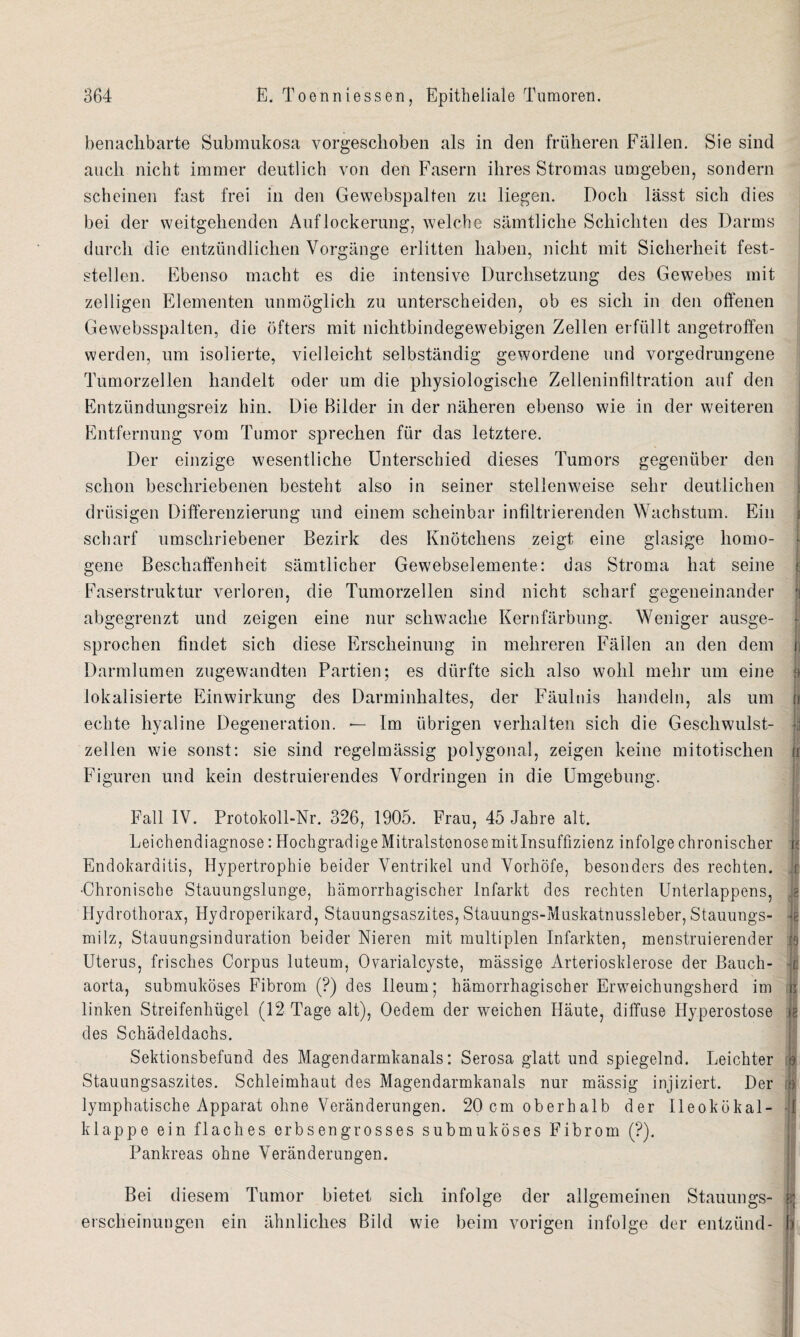 benachbarte Submukosa vorgeschoben als in den früheren Fällen. Sie sind auch nicht immer deutlich von den Fasern ihres Stromas umgeben, sondern scheinen fast frei in den Gewebspalten zu liegen. Doch lässt sich dies bei der weitgehenden Auflockerung, welche sämtliche Schichten des Darms durch die entzündlichen Vorgänge erlitten haben, nicht mit Sicherheit fest¬ stellen. Ebenso macht es die intensive Durchsetzung des Gewebes mit zelligen Elementen unmöglich zu unterscheiden, ob es sich in den offenen Gewebsspalten, die öfters mit nichtbindegewebigen Zellen erfüllt angetroffen werden, um isolierte, vielleicht selbständig gewordene und vorgedrungene Tumorzellen handelt oder um die physiologische Zelleninfiltration auf den Entzündungsreiz hin. Die Bilder in der näheren ebenso wie in der weiteren Entfernung vom Tumor sprechen für das letztere. Der einzige wesentliche Unterschied dieses Tumors gegenüber den schon beschriebenen besteht also in seiner stellenweise sehr deutlichen drüsigen Differenzierung und einem scheinbar infiltrierenden Wachstum. Ein scharf umschriebener Bezirk des Knötchens zeigt eine glasige homo¬ gene Beschaffenheit sämtlicher Gewebselemente: das Stroma hat seine ü Faserstruktur verloren, die Tumorzellen sind nicht scharf gegeneinander abgegrenzt und zeigen eine nur schwache Kernfärbung. Weniger ausge¬ sprochen findet sich diese Erscheinung in mehreren Fällen an den dem n Darmlumen zugewandten Partien; es dürfte sich also wohl mehr um eine | lokalisierte Einwirkung des Darminhaltes, der Fäulnis handeln, als um ji echte hyaline Degeneration. — Im übrigen verhalten sich die Geschwulst- | zellen wie sonst: sie sind regelmässig polygonal, zeigen keine mitotischen n Figuren und kein destruierendes Vordringen in die Umgebung. Fall IV. Protokoll-Nr. 326, 1905. Frau, 45 Jahre alt. Leichendiagnose: Hochgradige Mitralstenosemitlnsuffizienz infolge chronischer ü Endokarditis, Hypertrophie beider Ventrikel und Vorhöfe, besonders des rechten, r •Chronische Stauungslunge, hämorrhagischer Infarkt des rechten Unterlappens, e Hydrothorax, Hydroperikard, Stauungsaszites, Stauungs-Muskatnussleber, Stauungs- lg milz, Stauungsinduration beider Nieren mit multiplen Infarkten, menstruierender iS Uterus, frisches Corpus luteum, Ovarialcyste, massige Arteriosklerose der Bauch- | aorta, submuköses Fibrom (?) des Ileum; hämorrhagischer Erweichungsherd im ii linken Streifenhügel (12 Tage alt), Oedem der weichen Häute, diffuse Hyperostose 15 des Schädeldachs. Sektionsbefund des Magendarmkanals: Serosa glatt und spiegelnd. Leichter jjj Stauungsaszites. Schleimhaut des Magendarmkanals nur mässig injiziert. Der o lymphatische Apparat ohne Veränderungen. 20 cm oberhalb der Ileokökal- I klappe ein flaches erbsengrosses submuköses Fibrom (?). Pankreas ohne Veränderungen. — Bei diesem Tumor bietet sich infolge der allgemeinen Stauungs- | erscheinungen ein ähnliches Bild wie beim vorigen infolge der entzünd- b