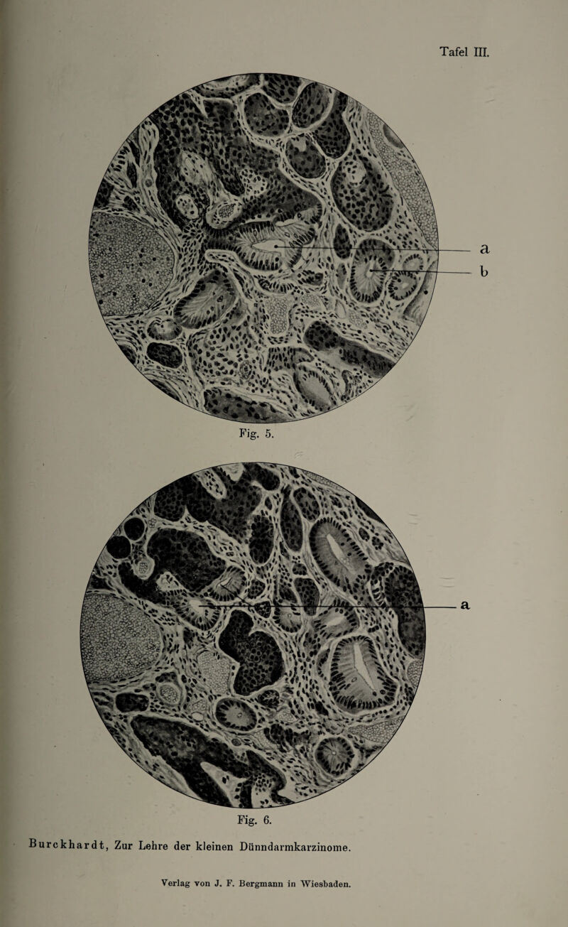 fei SrffiTV* '.iVV**^** a b Fig. 5. Fig. 6. . X >'''* Burckhardt, Zur Lehre der kleinen Dünndarmkarzinome. a