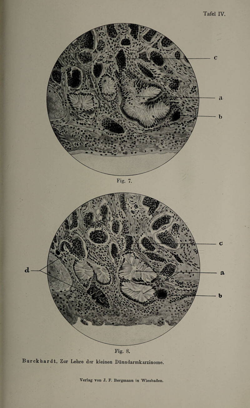 a b Fi 7. C d a b Fig. 8. Burckhardt, Zur Lehre der kleinen Dünndarmkarzinome.