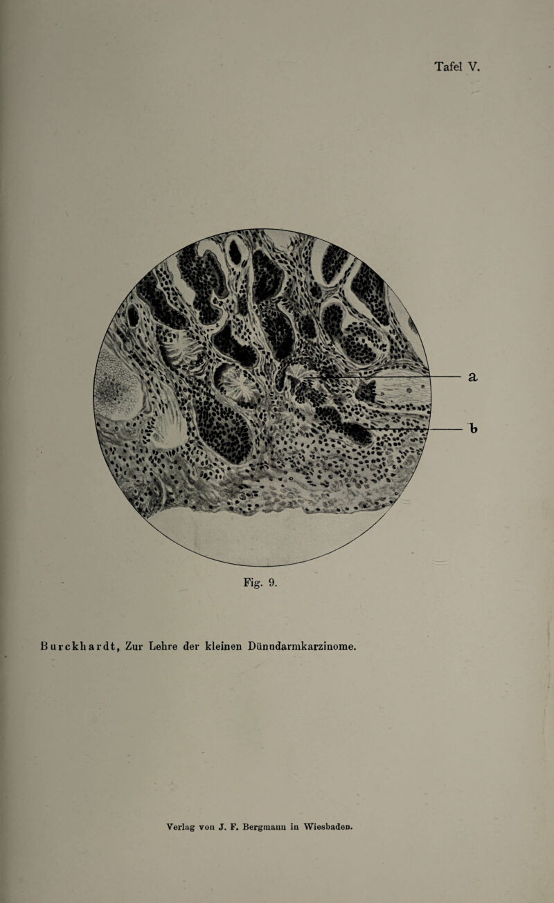 a Fig. 9. urckliardt, Zur Lehre der kleinen Dünndarmkarzinome.