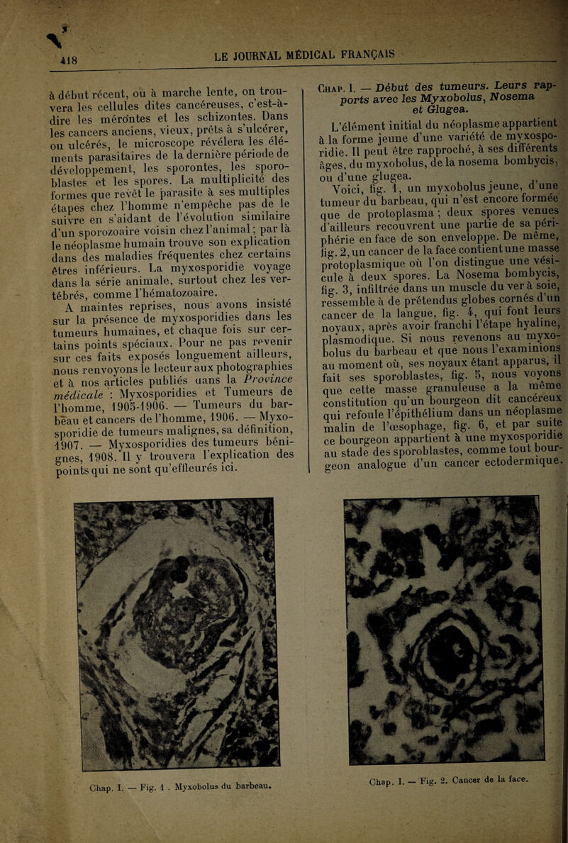 418 à début récent, ou à marche lente, on trou¬ vera les cellules dites cancéreuses, c est-à- dire les mérontes et les schizontes. Dans les cancers anciens, vieux, prêts à s’ulcérer, ou ulcérés, le microscope révélera les élé¬ ments parasitaires de la dernière période de développement, les sporontes, les sporo- blastes et les spores. La multiplicité des formes que revêt le parasite à ses multiples étapes chez l’homme n’empêche pas de le suivre en s’aidant de l’évolution similaire d’un sporozoaire voisin chezl animal, par là le néoplasme humain trouve son explication dans des maladies fréquentes chez certains êtres inférieurs. La myxosporidie voyage dans la série animale, surtout chez les ver¬ tébrés, comme l’hématozoaire. A maintes reprises, nous avons insisté sur la présence de myxosporidies dans les tumeurs humaines, et chaque fois sur cer¬ tains points spéciaux. Pour ne pas revenir sur ces faits exposés longuement ailleurs, nous renvoyons le lecteur aux photogiaphies et à nos articles publiés uans la Province médicale : Myxosporidies et Tumeurs de l’homme, 1905-1906. — Tumeurs du bar¬ beau et cancers de l’homme, 1906. — Myxo¬ sporidie de tumeurs malignes, sa définition, I9Q7 — Myxosporidies des tumeurs béni¬ gnes, 1908. Il y trouvera l’explication des points qui ne sont qu’effleurés ici. Chap. I. — Début des tumeurs. Leurs rap¬ ports avec les Myxobolus, Nosema et Glugea. L’élément initial du néoplasme appartient à la forme jeune d’une variété de myxospo¬ ridie. 11 peut être rapproché, à ses différents âges, du myxobolus, de la nosema bombycis, ou d’une glugea. Voici, fig. 1, un myxobolus jeune, d une tumeur du barbeau, qui n’est encore formée que de protoplasma , deux spoies venues d’ailleurs recouvrent une partie de sa péri¬ phérie en face de son enveloppe. De même, fig. 2, un cancer de la face contient une masse protoplasmique où l’on distingue une vési¬ cule à deux spores. La Nosema bombycis, fig. 3, infiltrée dans un muscle du ver à soie, ressemble à de prétendus globes cornés d un cancer de la langue, fig. 4, qui font leurs novaux, après avoir franchi 1 étape hyaline, plasmodique. Si nous revenons au myxo¬ bolus du barbeau et que nous Texammions au moment où, ses noyaux étant apparus, il fait ses sporoblastes, fig. 5, nous voyons que cette masse granuleuse a la meme constitution quun bourgeon dit cancéreux qui refoule l’épithélium dans un néoplasme malin de l’œsophage, fig. 6, et par suite ce bourgeon appartient à une myxosporiaie au stade des sporoblastes, comme tout bour¬ geon analogue d’un cancer ectodermique. Chap. I. — Fig. 1 . Myxobolus du barbeau.