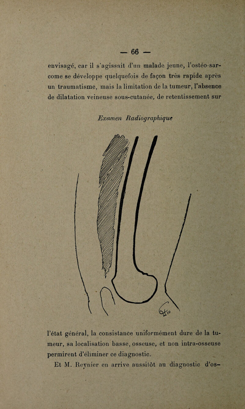 * - 66 — envisagé, car il s’agissait d’un malade jeune, l’ostéo-sar¬ come se développe quelquefois de façon très rapide après un traumatisme, mais la limitation de la tumeur, l’absence de dilatation veineuse sous-cutanée, de retentissement sur Examen Radiographique l’état général, la consistance uniformément dure de la tu¬ meur, sa localisation basse, osseuse, et non intra-osseuse permirent d’éliminer ce diagnostic. Et M. Reynier en arrive aussitôt au diagnostic d’os-
