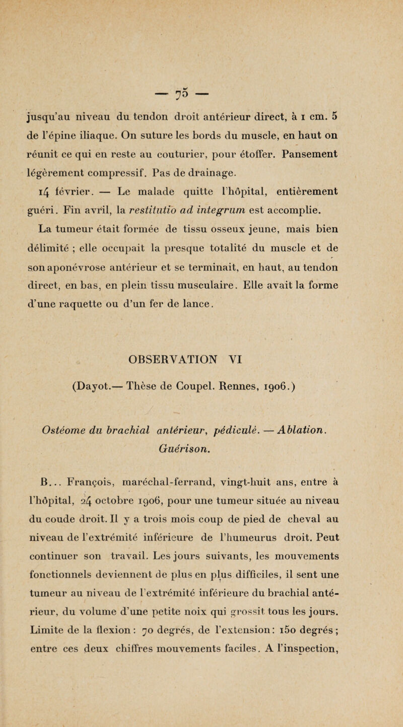de l’épine iliaque. On suture les bords du muscle, en haut on réunit ce qui en reste au couturier, pour étoffer. Pansement légèrement compressif. Pas de drainage. i4 février. — Le malade quitte l’hôpital, entièrement guéri. Fin avril, la restitntio ad integrum est accomplie. La tumeur était formée de tissu osseux jeune, mais bien délimité ; elle occupait la presque totalité du muscle et de son aponévrose antérieur et se terminait, en haut, au tendon direct, en bas, en plein tissu musculaire. Elle avait la forme d’une raquette ou d’un fer de lance. OBSERVATION VI (Dayot.-— Thèse de Coupel. Rennes, 1906.) Ostéome du brachial antérieur, pédiculé. —Ablation. Guérison. B... François, maréchal-ferrand, vingt-huit ans, entre à * « l’hôpital, 24 octobre 1906, pour une tumeur située au niveau du coude droit. Il y a trois mois coup de pied de cheval au niveau de l’extrémité inférieure de l’humeurus droit. Peut continuer son travail. Les jours suivants, les mouvements fonctionnels deviennent de plus en plus difficiles, il sent une tumeur au niveau de l’extrémité inférieure du brachial anté- i t rieur, du volume d’une petite noix qui grossit tous les jours. Limite de la flexion: 70 degrés, de l’extension: i5o degrés; entre ces deux chiffres mouvements faciles. A l’inspection,