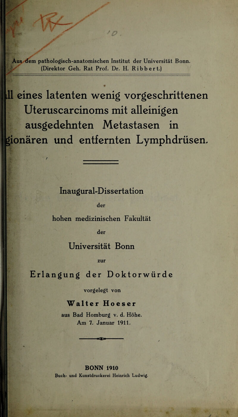 * A ■* * V 1 /F 1/ V r y Aus dem pathologisch-anatomischen Institut der Universität Bonn. (Direktor Geh. Rat Prof. Dr. H. Ribbert.) 11 eines latenten wenig vorgeschrittenen Uteruscarcinoms mit alleinigen ausgedehnten Metastasen in 'ionären und entfernten Lymphdrüsen. Inaugural-Dissertation der hohen medizinischen Fakultät der Universität Bonn zur Erlangung der Doktorwürde vorgelegt von Walter Hoeser aus Bad Homburg v. d. Höhe. Am 7. Januar 1911. BONN 1910 Buch- und Kunstdruckerei Heinrich Ludwig. j