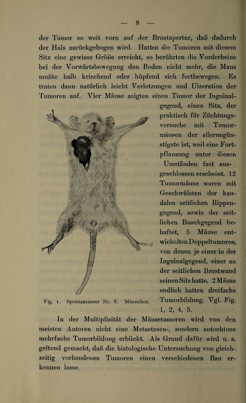der Tumor so weit vorn auf der Brustapertur, daß dadurch der Hals zurückgebogen wird. Hatten die Tumoren mit diesem Sitz eine gewisse Größe erreicht, so berührten die Vorderbeine bei der Vorwärtsbewegung den Boden nicht mehr, die Maus mußte halb kriechend oder hüpfend sich fortbewegen. Es traten dann natürlich leicht Verletzungen und Ulzeration der Tumoren auf. Vier Mäuse zeigten einen Tumor der Inguinal¬ gegend, einen Sitz, der j--: / fas: <£• '*. % f *? • ~mkA I i ä a ■ Fig. i. Spontantumor Nr. 8. Männchen. praktisch für Züchtungs¬ versuche mit Tumor¬ mäusen der allerungün¬ stigste ist, weil eine Fort¬ pflanzung unter diesen Umständen fast aus¬ geschlossen erscheint. 12 Tumormäuse waren mit Geschwülsten der kau¬ dalen seitlichen Rippen¬ gegend, sowie der seit¬ lichen Bauchgegend be¬ haftet, 5 Mäuse ent- wickelten Doppeltumoren, von denen je einer in der Inguinalgegend, einer an der seitlichen Brustwand seinen Sitz hatte. 2 Mäuse endlich hatten dreifache Tumorbildung. Vgl. Fig. 1, 2, 4, 5. In der Multiplizität der Mäusetumoren wird von den meisten Autoren nicht eine Metastasen-, sondern autochtone mehrfache Tumorbildung erblickt. Als Grund dafür wird u. a. geltend gemacht, daß die histologische Untersuchung von gleich¬ zeitig vorhandenen Tumoren einen verschiedenen Bau er¬ kennen lasse.