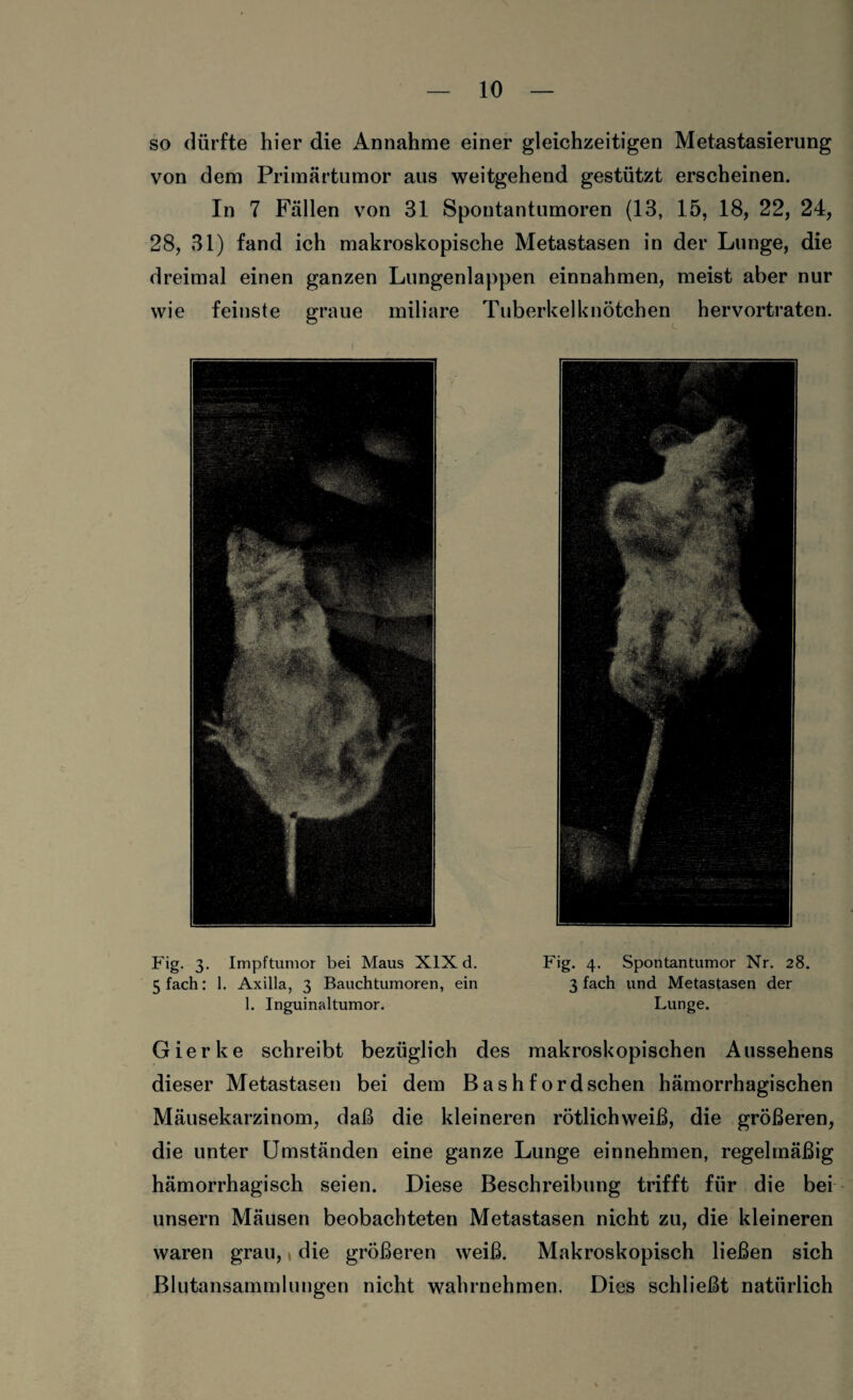 so dürfte hier die Annahme einer gleichzeitigen Metastasierung von dem Primärtumor aus weitgehend gestützt erscheinen. In 7 Fällen von 31 Spoutantumoren (13, 15, 18, 22, 24, 28, 31) fand ich makroskopische Metastasen in der Lunge, die dreimal einen ganzen Lungenlappen einnahmen, meist aber nur wie feinste graue miliare Tuberkelknötchen hervortraten. Fig. 3. Impftumor bei Maus XIX d. Fig. 4. Spontantumor Nr. 28. 5 fach: 1. Axilla, 3 Bauchtumoren, ein 3 fach und Metastasen der 1. Inguinaltumor. Lunge. Gierke schreibt bezüglich des makroskopischen Aussehens dieser Metastasen bei dem Bashfordschen hämorrhagischen Mäusekarzinom, daß die kleineren rötlichweiß, die größeren, die unter Umständen eine ganze Lunge einnehmen, regelmäßig hämorrhagisch seien. Diese Beschreibung trifft für die bei unsern Mäusen beobachteten Metastasen nicht zu, die kleineren waren grau,, die größeren weiß. Makroskopisch ließen sich Blutansammluugen nicht wahrnehmen. Dies schließt natürlich