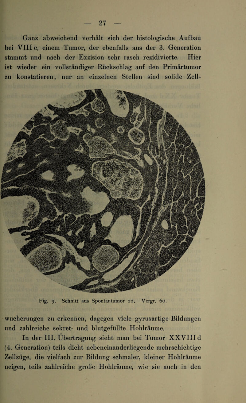 Ganz abweichend verhält sich der histologische Aufbau bei VIII c, einem Tumor, der ebenfalls aus der 3. Generation stammt und nach der Exzision sehr rasch rezidivierte. Hier ist wieder ein vollständiger Rückschlag auf den Primärtumor zu konstatieren, nur an einzelnen Stellen sind solide Zell- Fig. 9. Schnitt aus Spontantumor 2 2. Vergr. 60. Wucherungen zu erkennen, dagegen viele gyrusartige Bildungen und zahlreiche sekret- und blutgefüllte Hohlräume. In der III. Übertragung sieht man bei Tumor XXVIII d (4. Generation) teils dicht nebeneinanderliegende mehrschichtige Zellzüge, die vielfach zur Bildung schmaler, kleiner Hohlräume neigen, teils zahlreiche große Hohlräume, wie sie auch in den